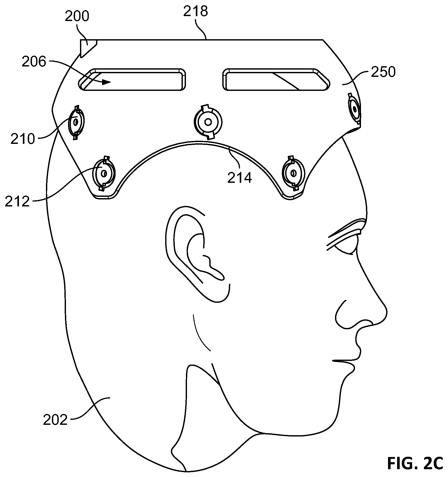 Patent US12551129 Figure 4 – Skull-contoured MRI localizer