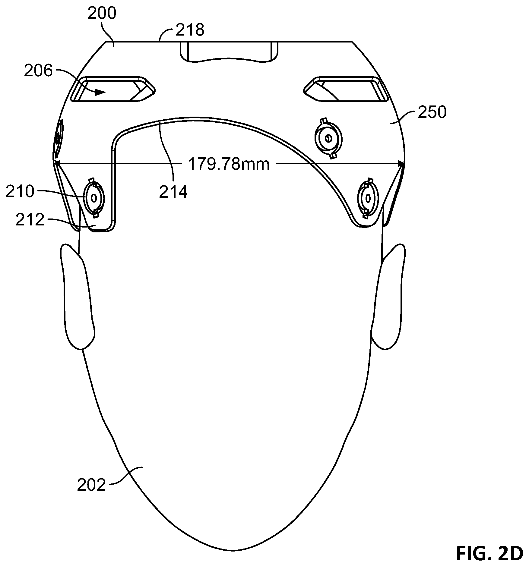 Patent US12551129 Figure 5 – Skull-contoured MRI localizer