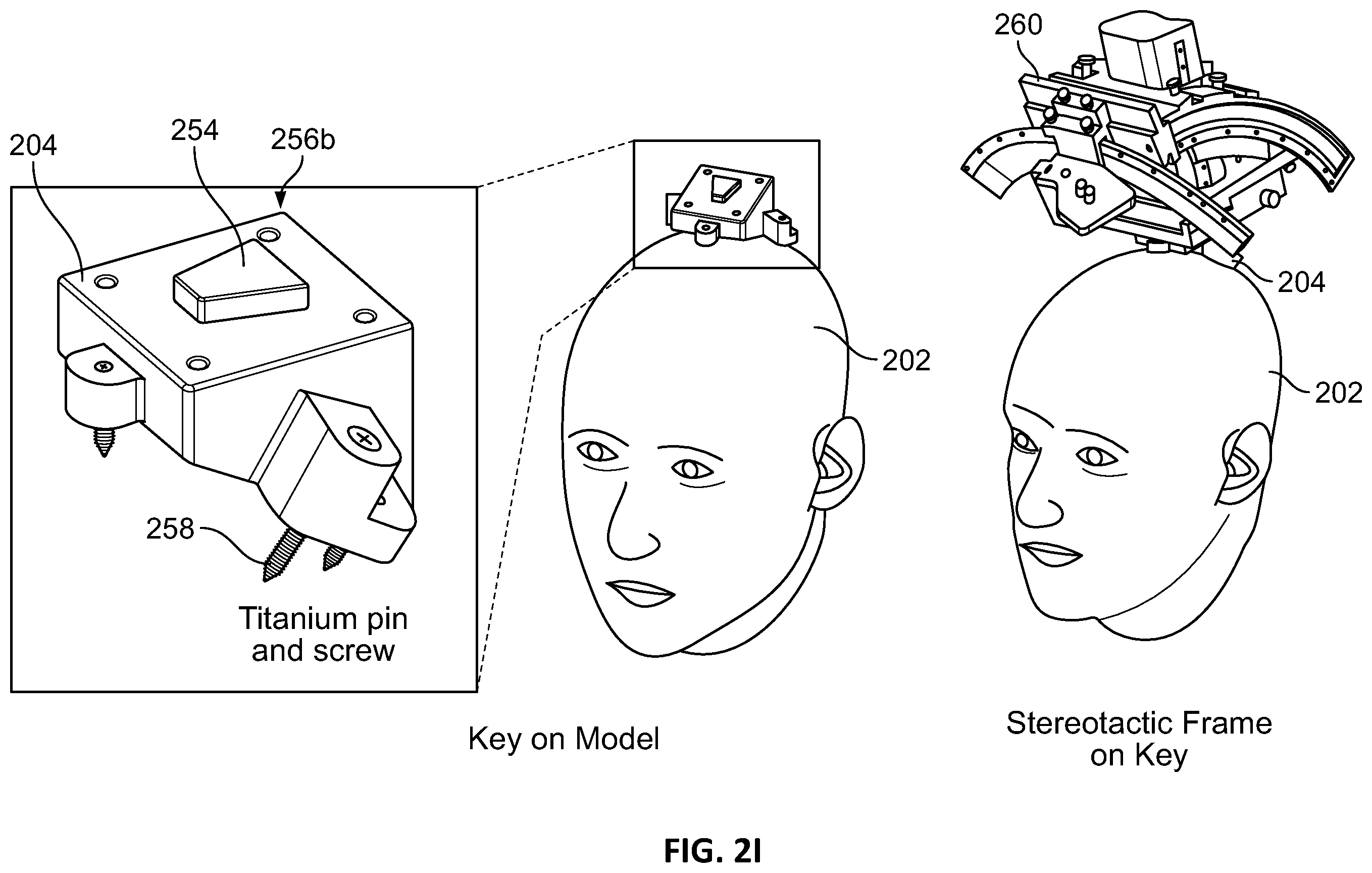 Patent US12551129 Figure 10 – Skull-contoured MRI localizer