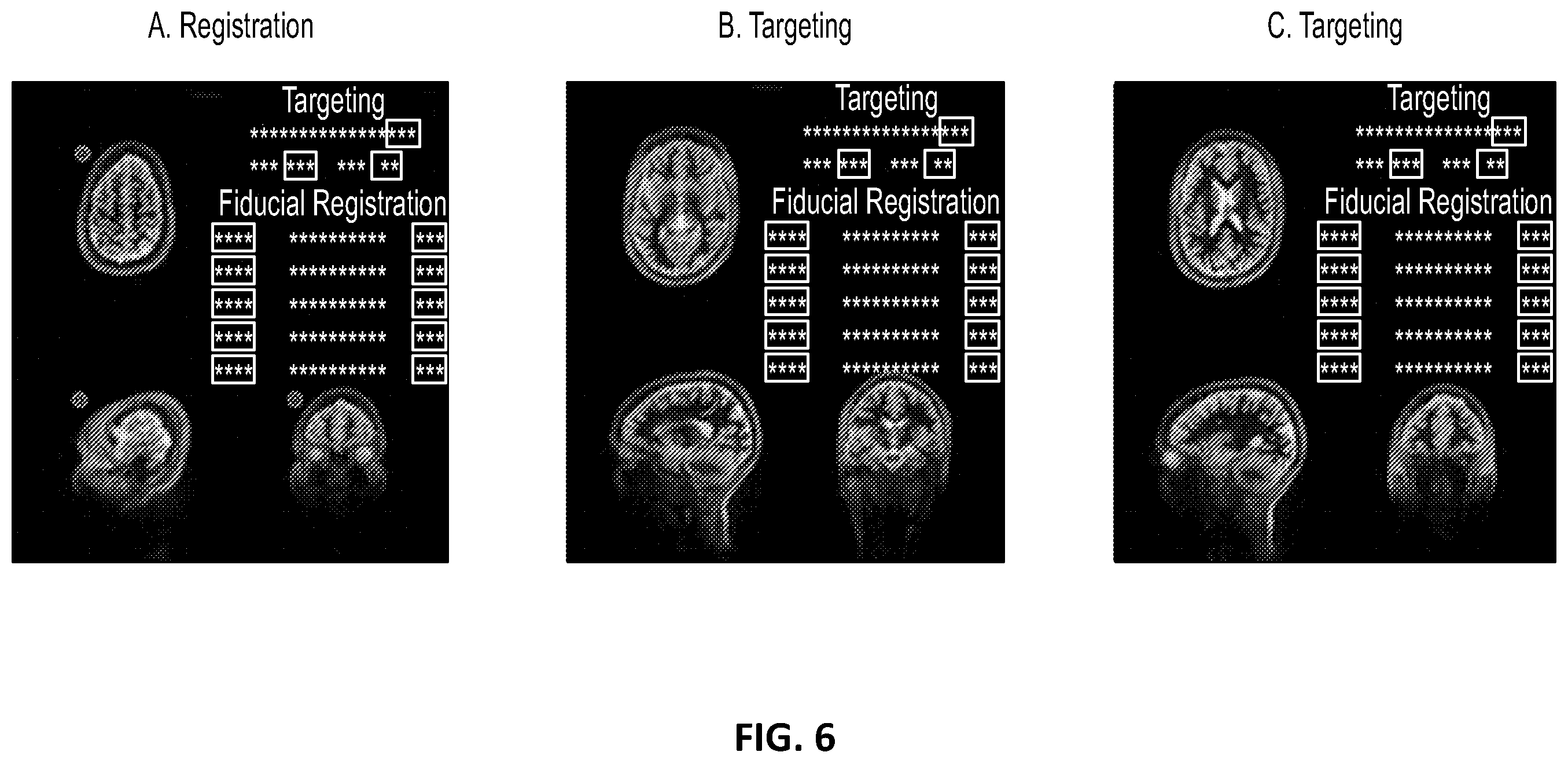 Patent US12551129 Figure 20 – Skull-contoured MRI localizer