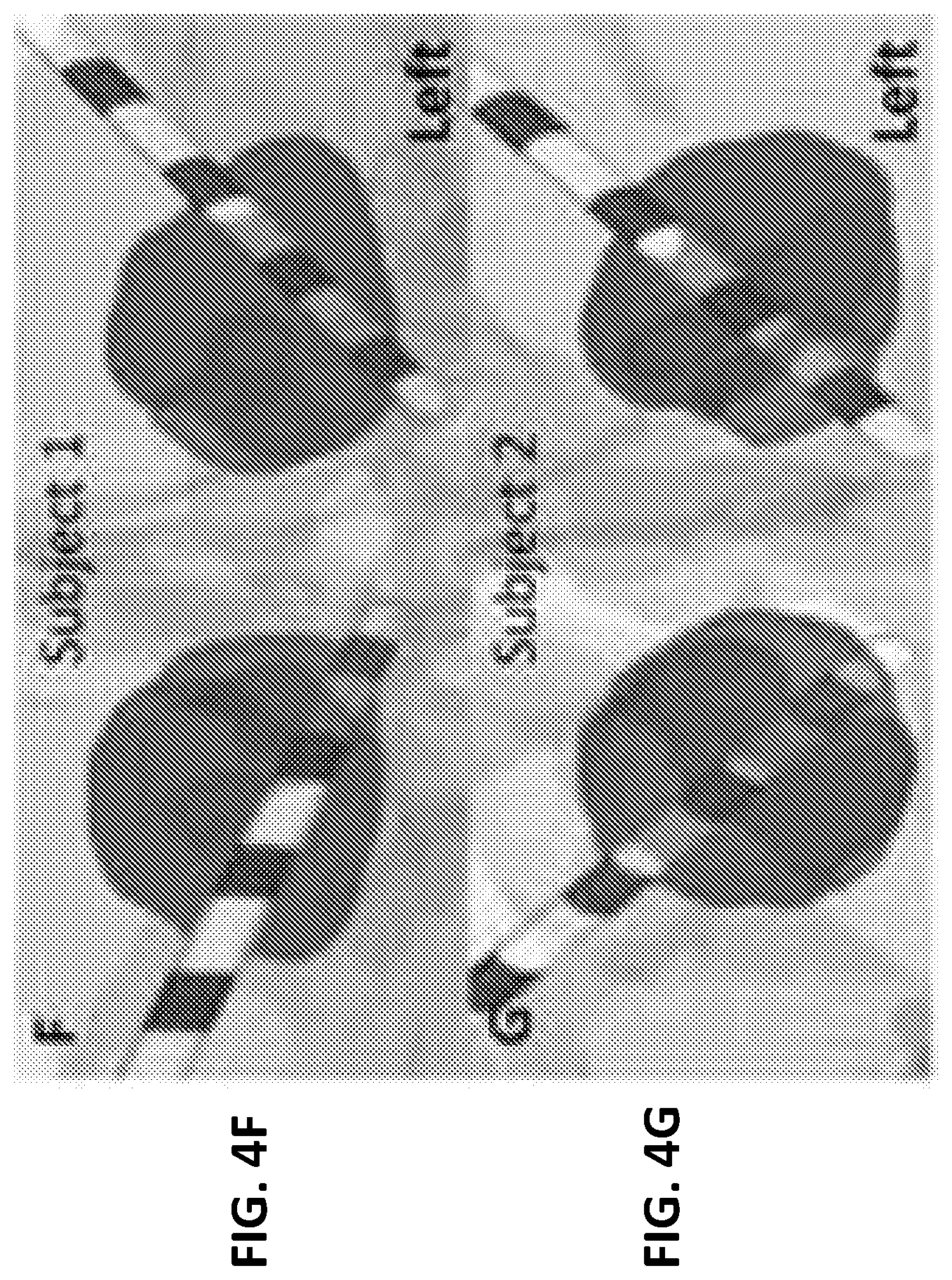 Patent US12551130 Figure 11 – Methods of targeting neural circuit for personalized neuromodulation for impulsivity-related or uncontrollable behaviors