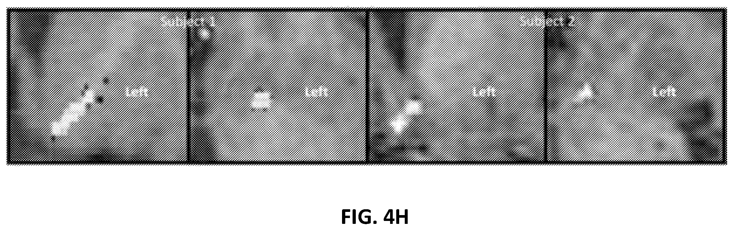 Patent US12551130 Figure 12 – Methods of targeting neural circuit for personalized neuromodulation for impulsivity-related or uncontrollable behaviors