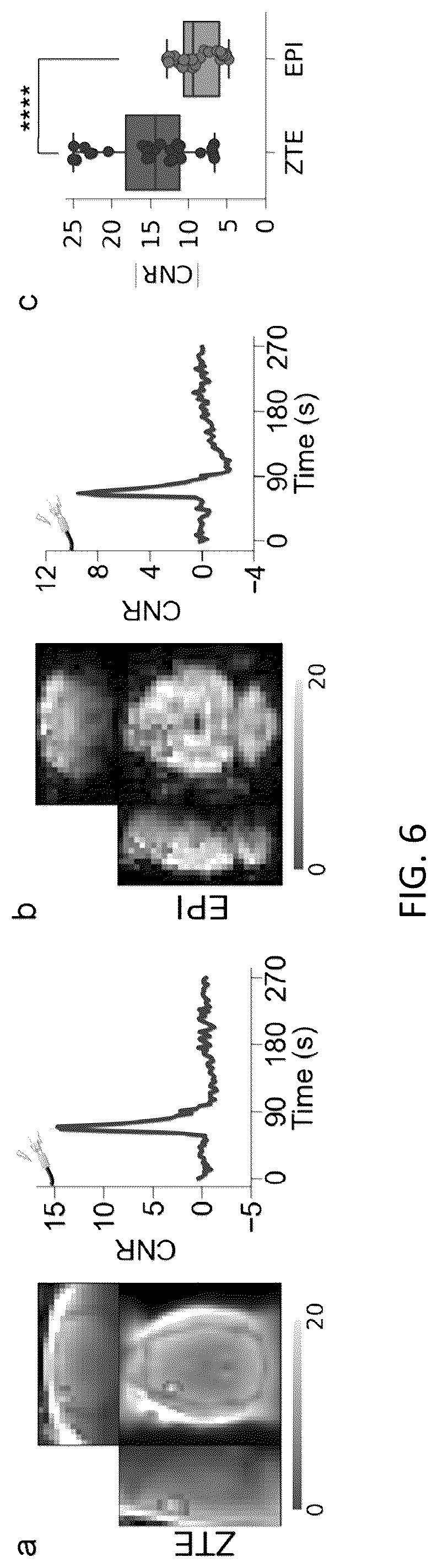 Patent US12551131 Figure 5 – Methods and systems for functional magnetic resonance imaging with a Zero Echo Time pulse-sequence