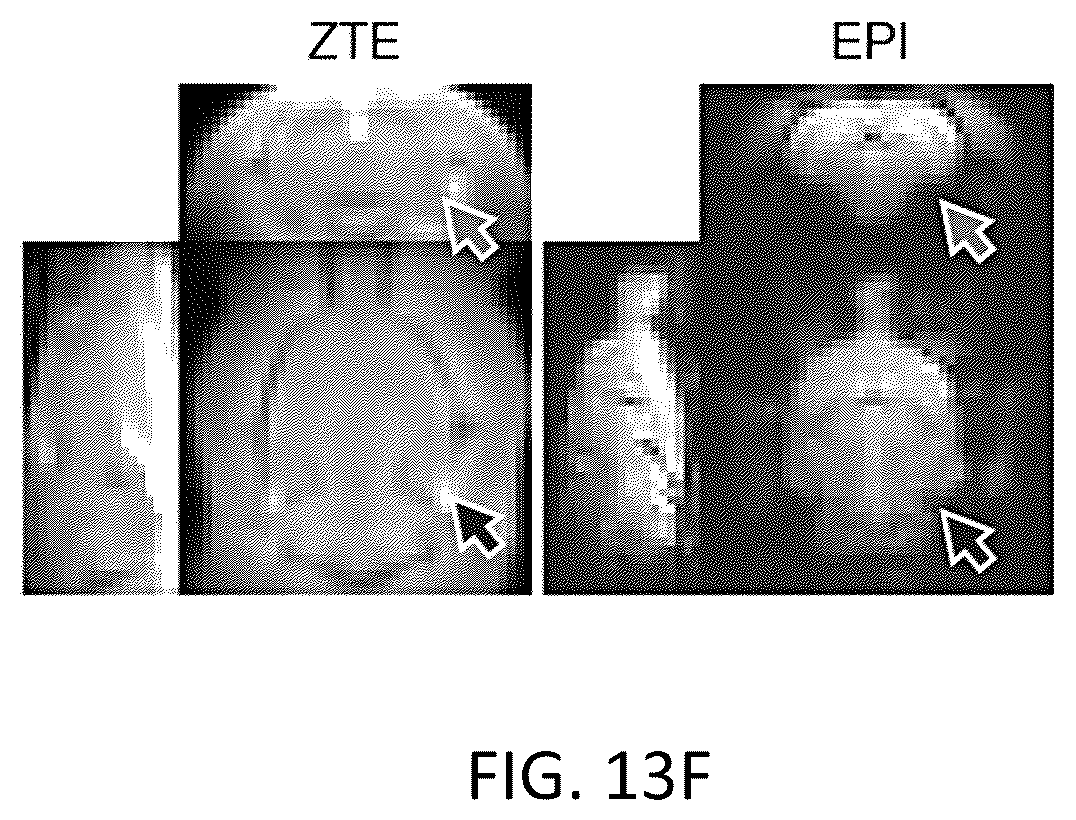 Patent US12551131 Figure 11 – Methods and systems for functional magnetic resonance imaging with a Zero Echo Time pulse-sequence