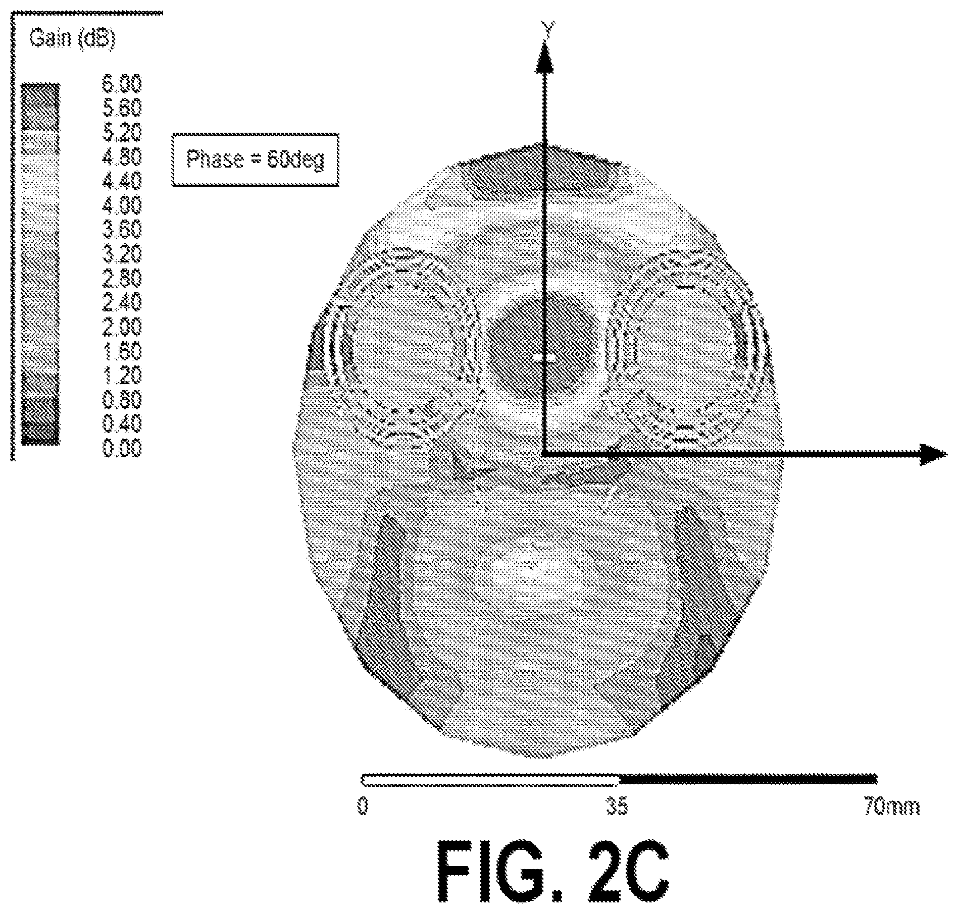 Patent US12551135 Figure 5 – Mobile ultrawideband radar monitoring thoracic fluid levels and cardio-respiratory function