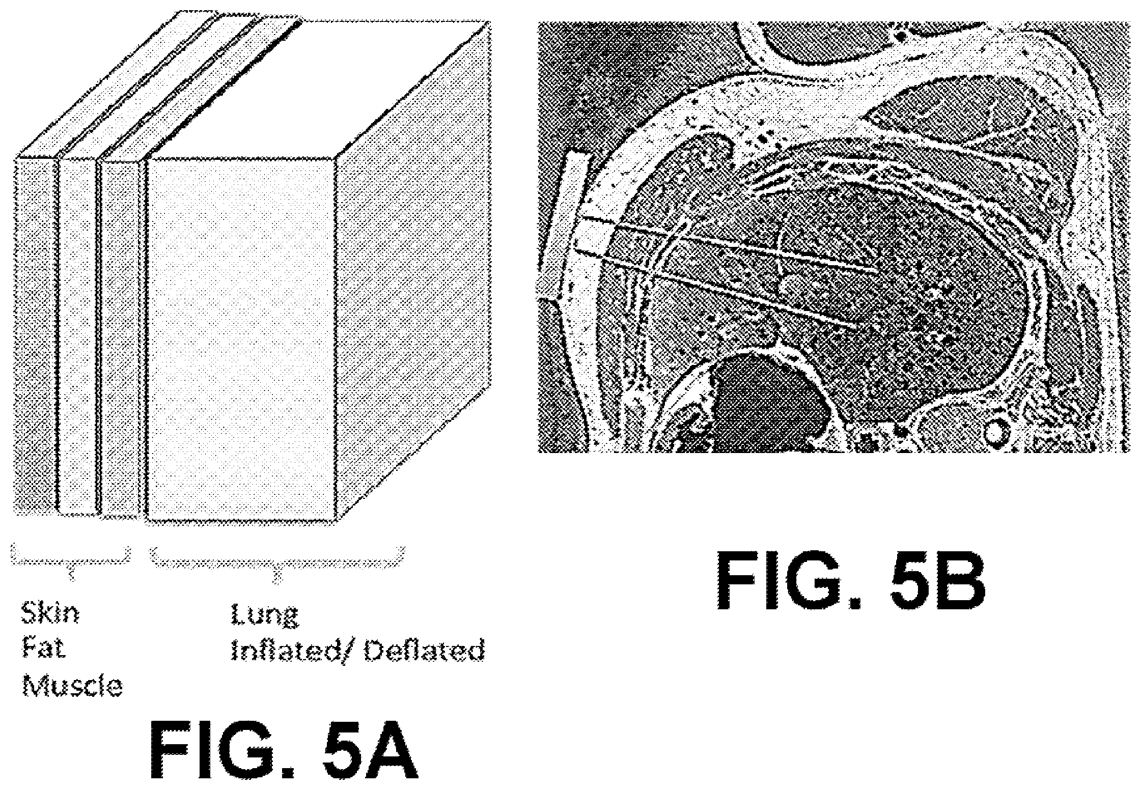 Patent US12551135 Figure 10 – Mobile ultrawideband radar monitoring thoracic fluid levels and cardio-respiratory function
