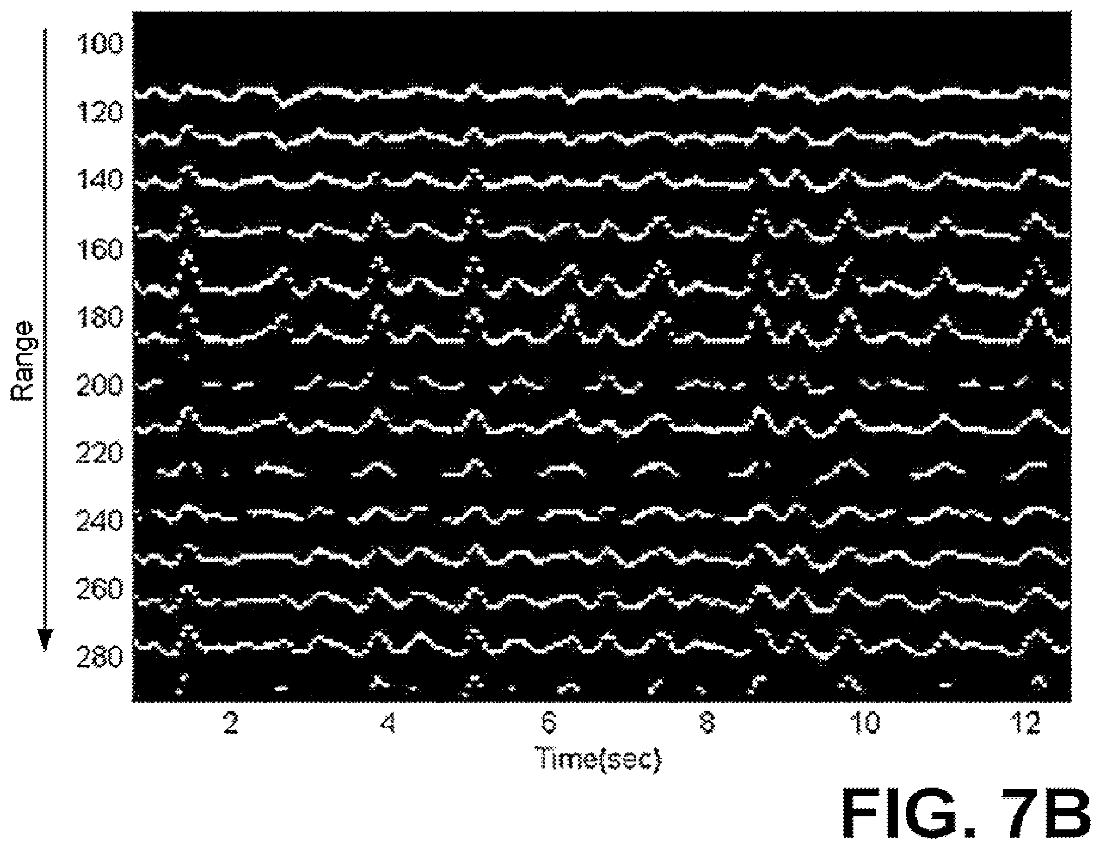 Patent US12551135 Figure 12 – Mobile ultrawideband radar monitoring thoracic fluid levels and cardio-respiratory function