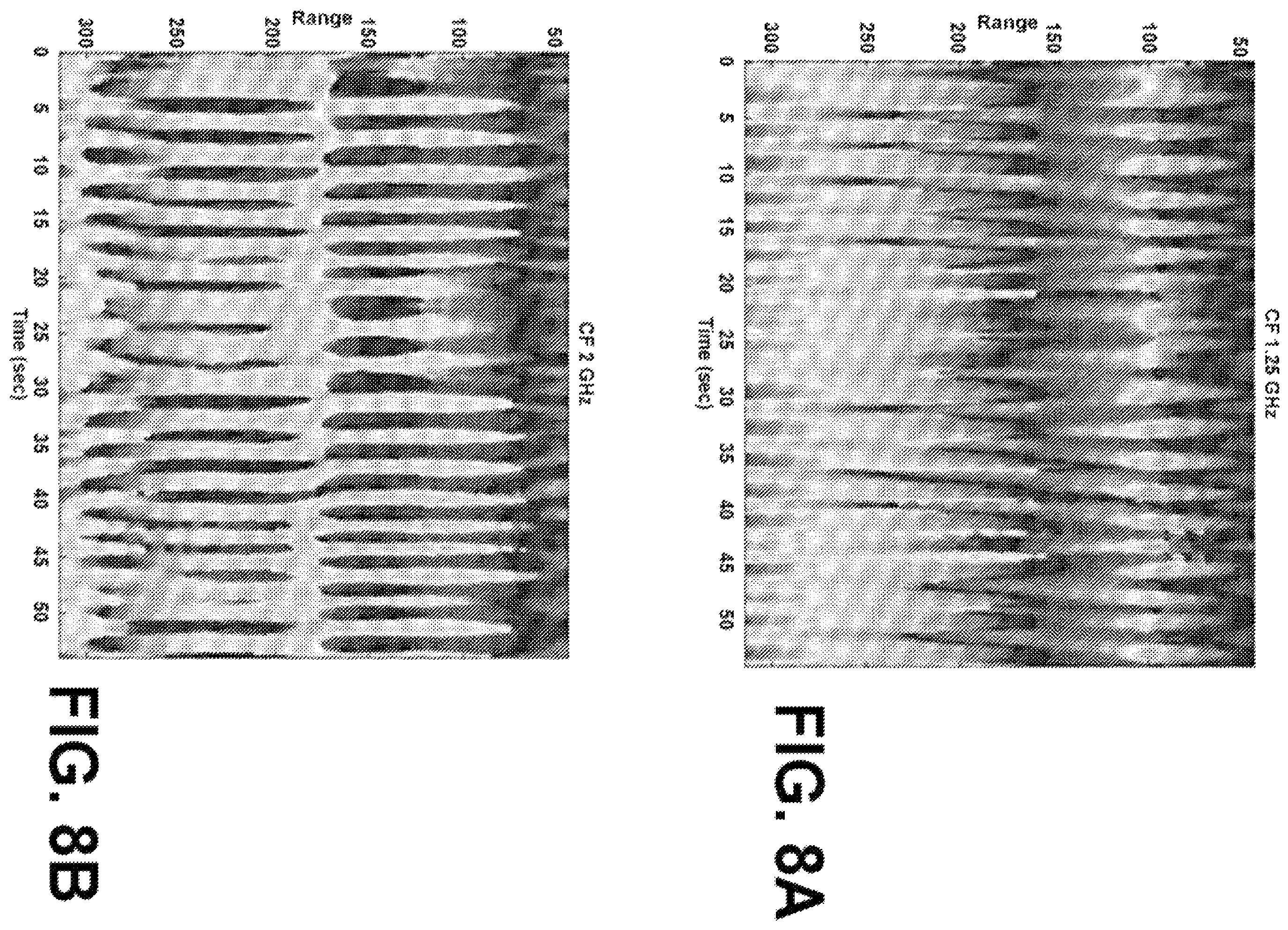 Patent US12551135 Figure 14 – Mobile ultrawideband radar monitoring thoracic fluid levels and cardio-respiratory function
