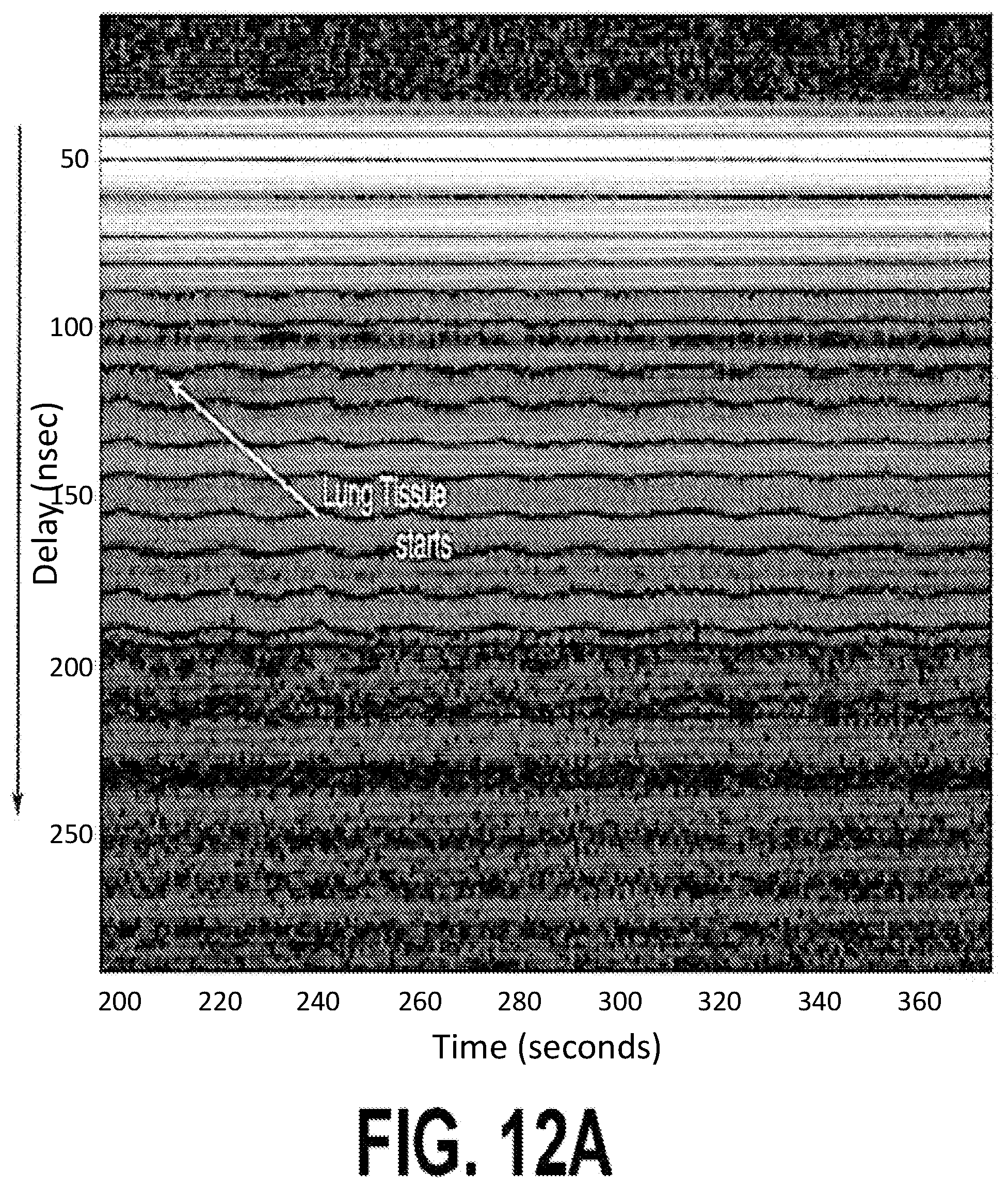 Patent US12551135 Figure 19 – Mobile ultrawideband radar monitoring thoracic fluid levels and cardio-respiratory function
