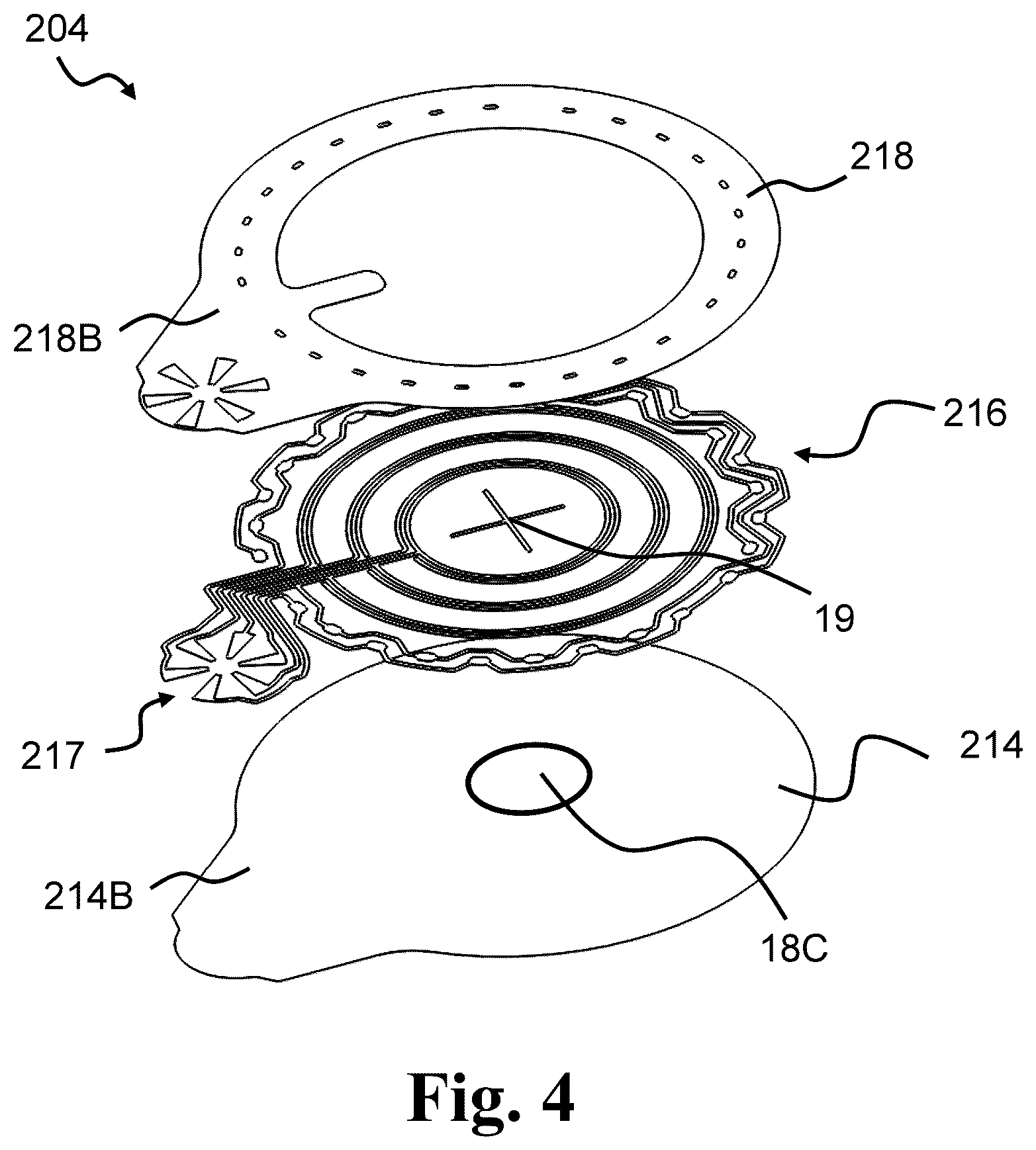 Patent US12551136 Figure 4 – Calibration methods for ostomy appliance tools