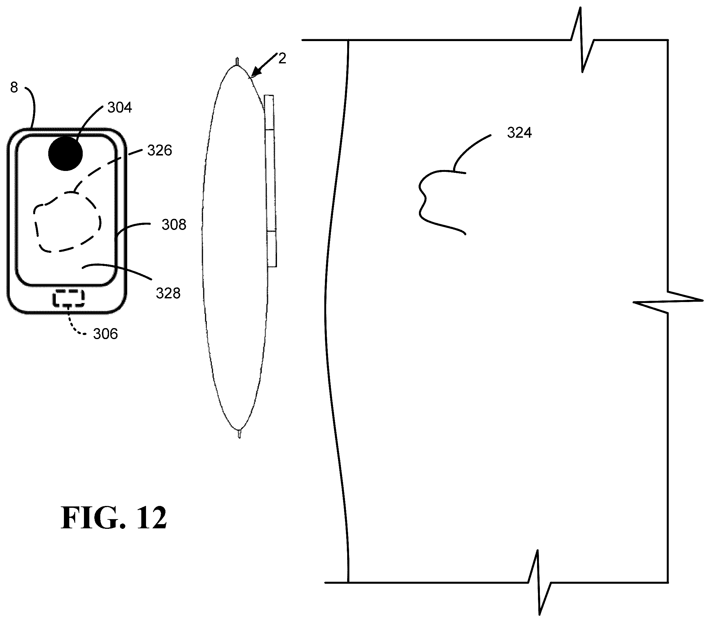Patent US12551136 Figure 11 – Calibration methods for ostomy appliance tools