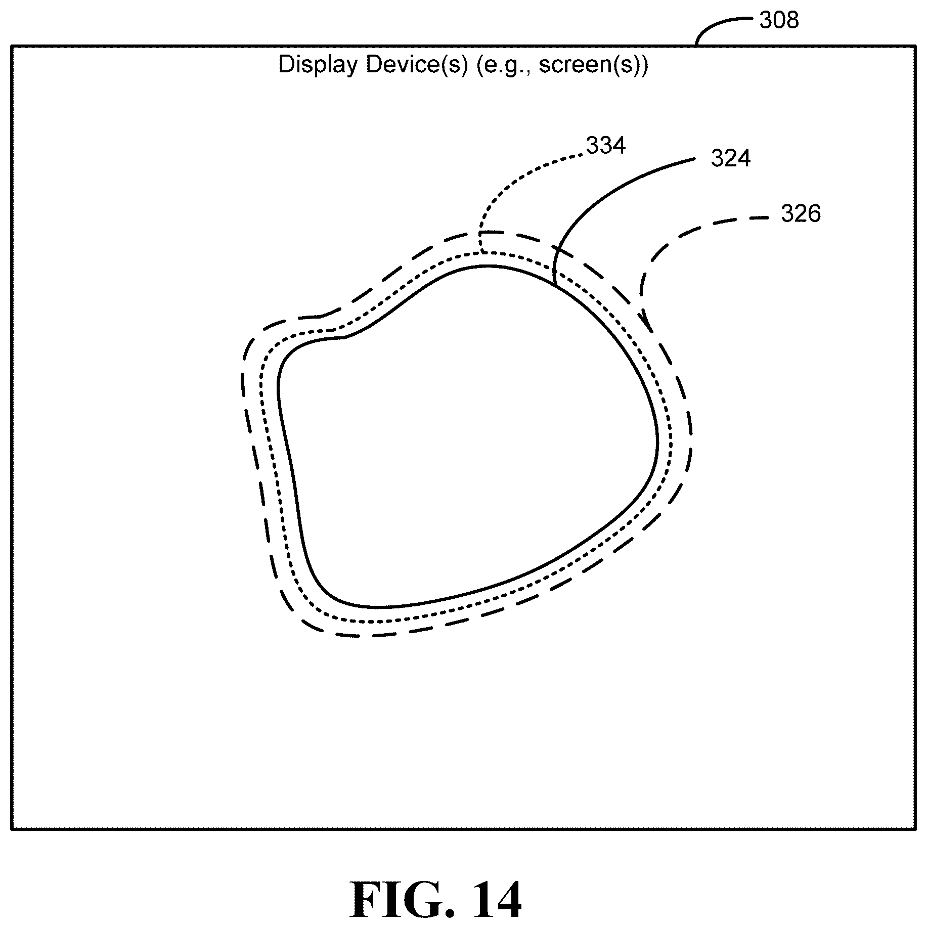 Patent US12551136 Figure 13 – Calibration methods for ostomy appliance tools
