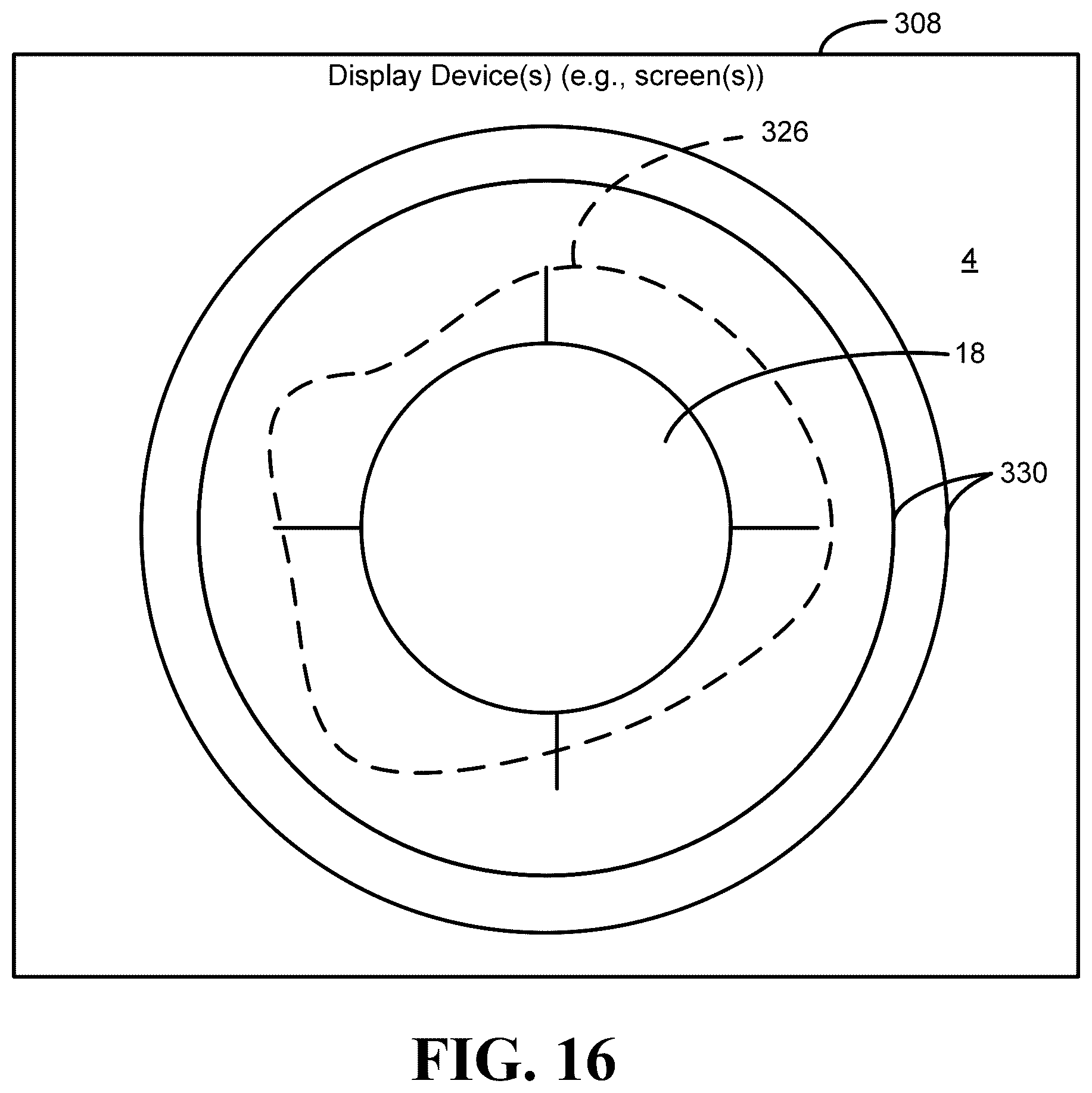 Patent US12551136 Figure 15 – Calibration methods for ostomy appliance tools