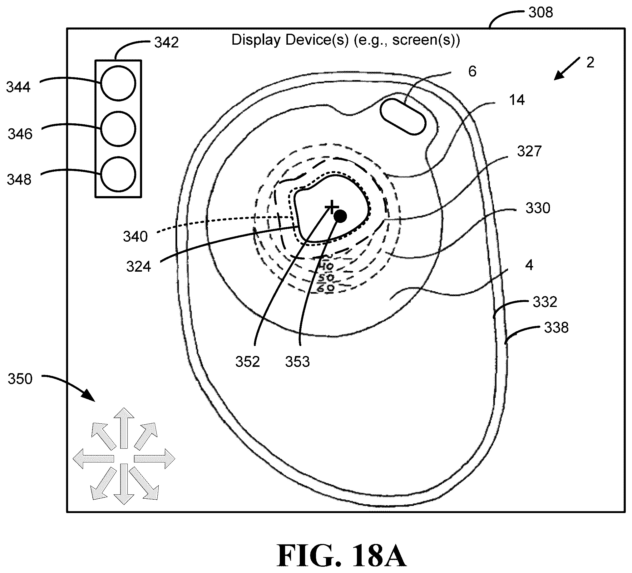 Patent US12551136 Figure 17 – Calibration methods for ostomy appliance tools