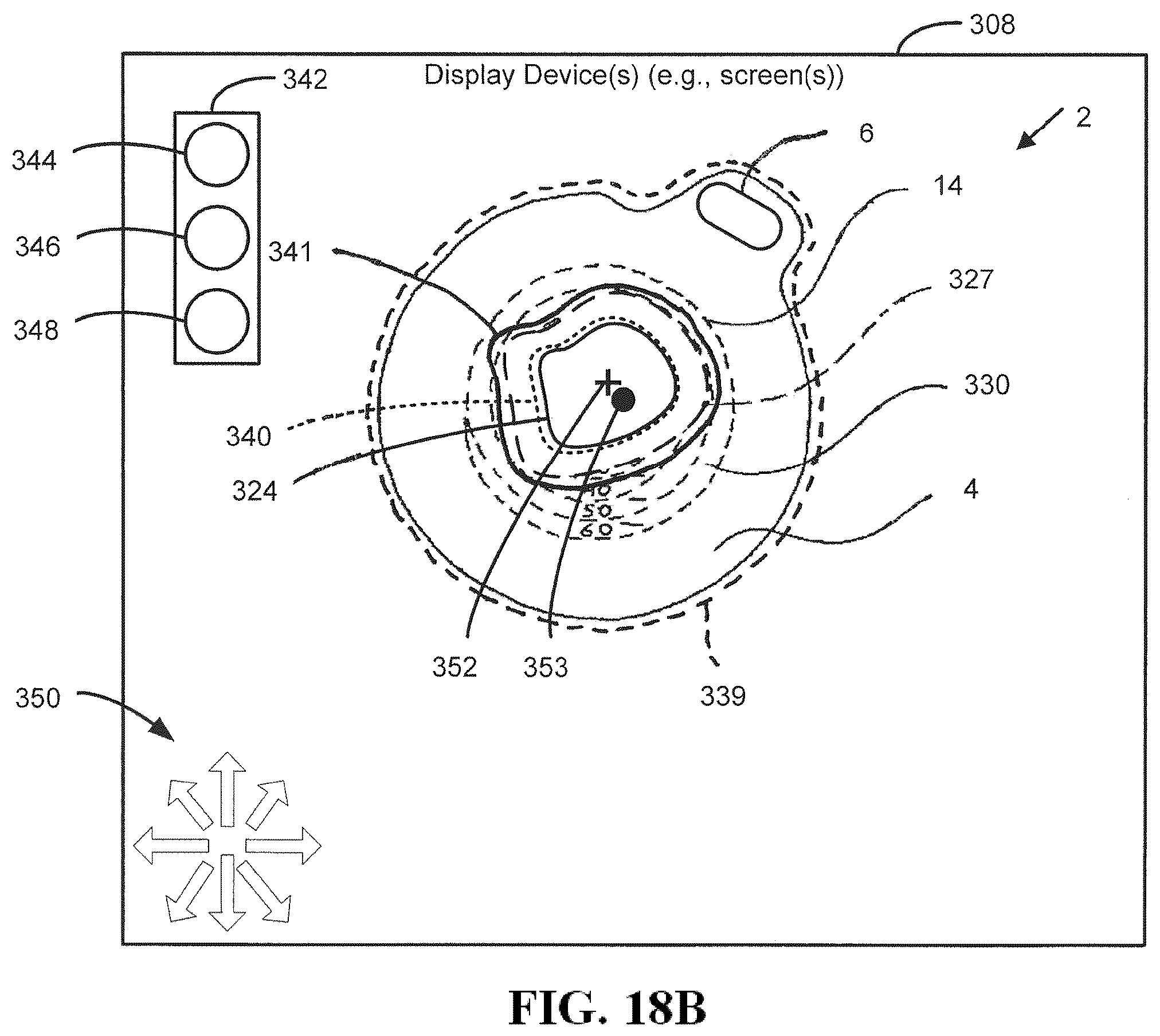 Patent US12551136 Figure 18 – Calibration methods for ostomy appliance tools