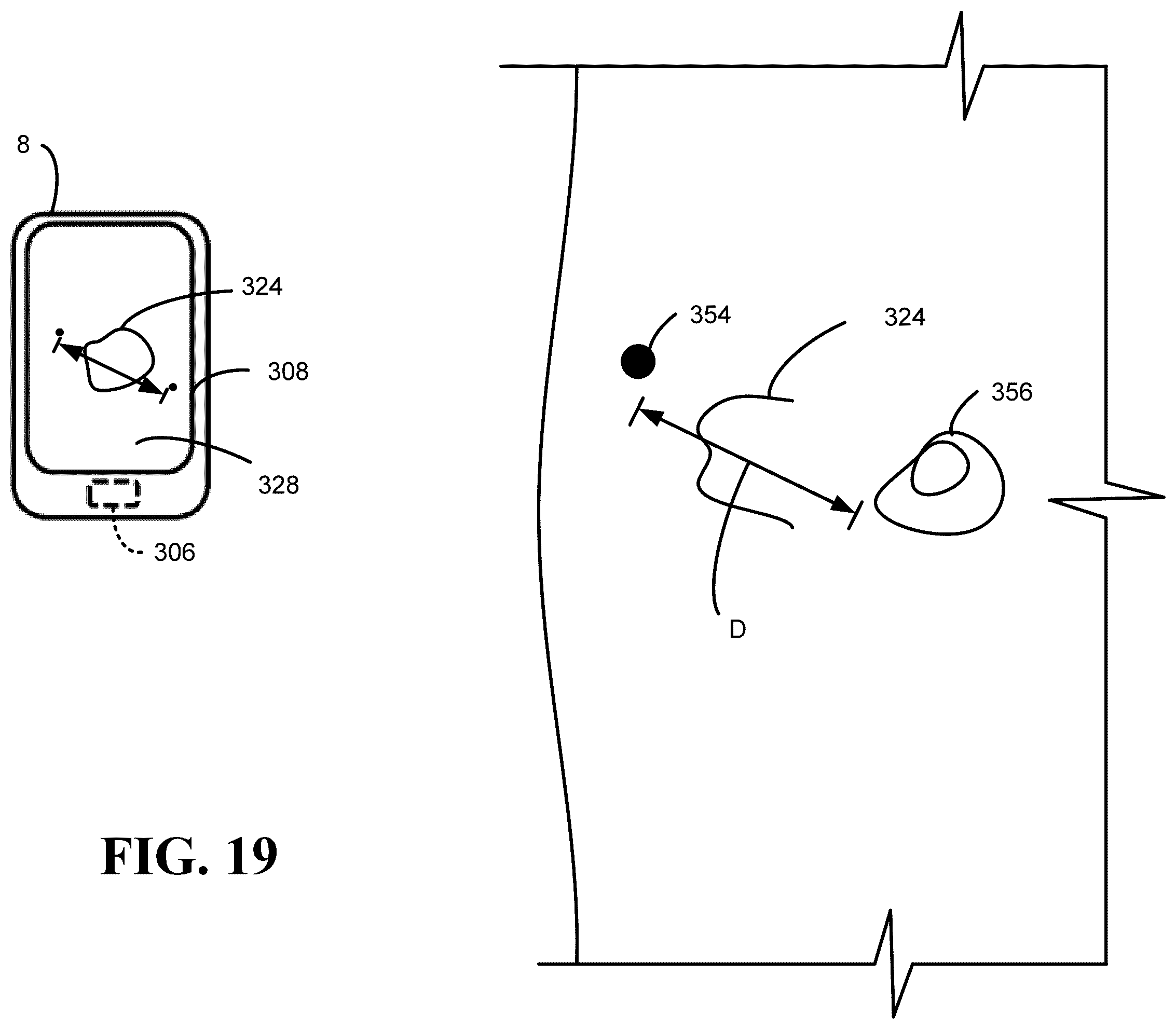 Patent US12551136 Figure 19 – Calibration methods for ostomy appliance tools
