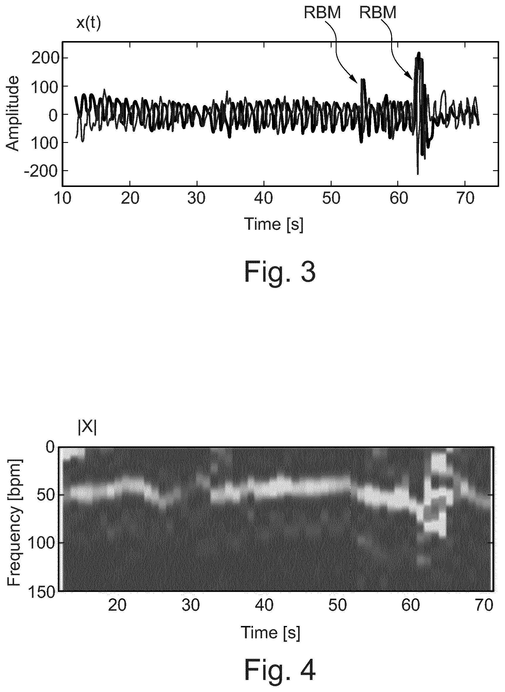 Patent US12551140 Figure 3 – System and method for mitigation of random body movement and interference effects in radar-based vital signs monitoring systems in medical applications