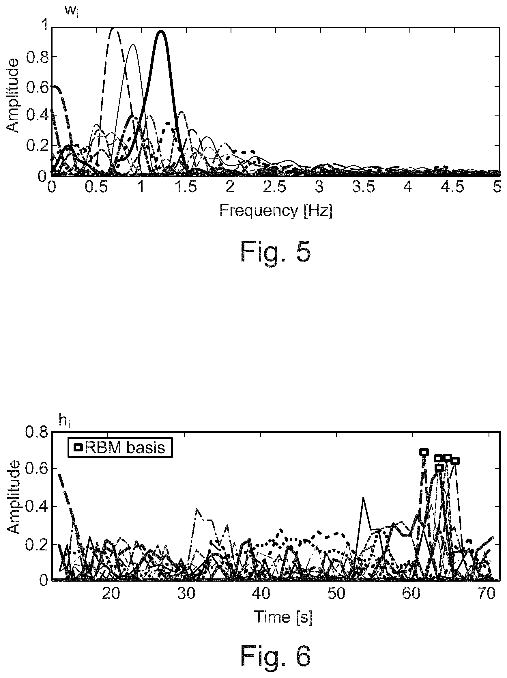 Patent US12551140 Figure 4 – System and method for mitigation of random body movement and interference effects in radar-based vital signs monitoring systems in medical applications