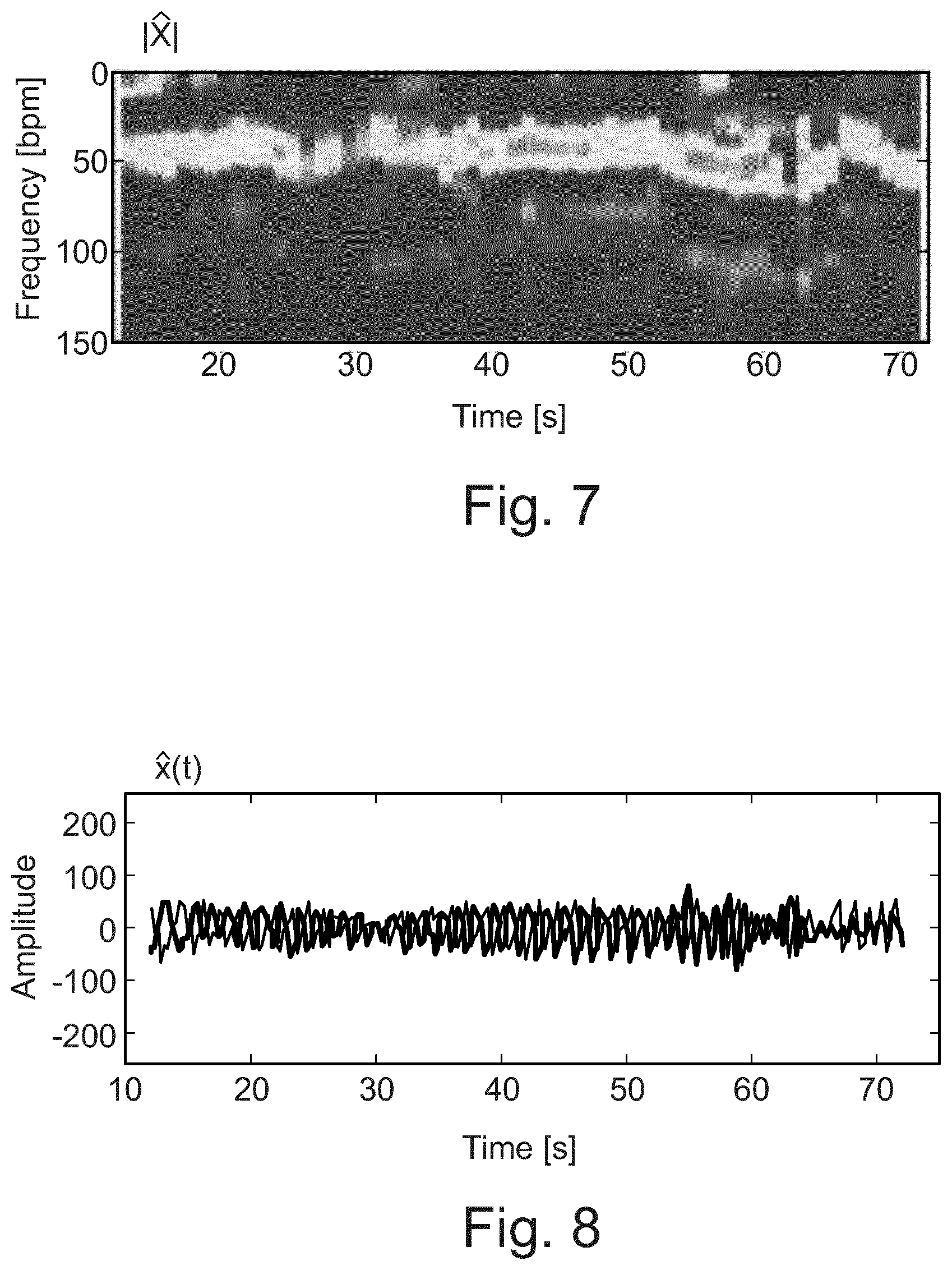 Patent US12551140 Figure 5 – System and method for mitigation of random body movement and interference effects in radar-based vital signs monitoring systems in medical applications