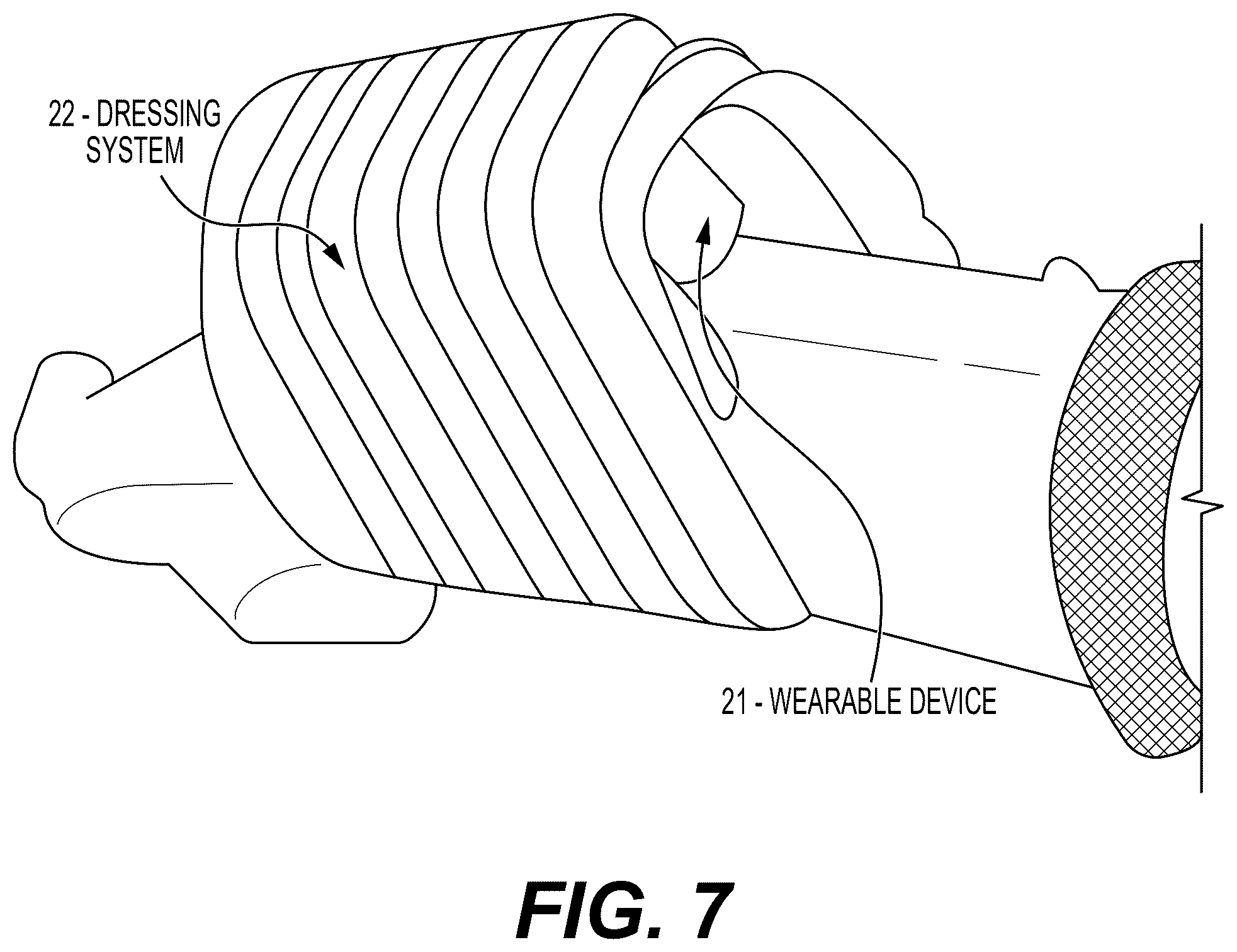 Patent US12551142 Figure 9 – Noninvasive device for monitor, detection, and diagnosis of diseases and human performance