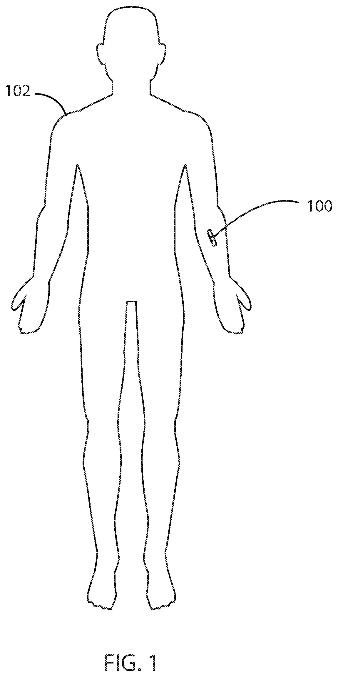 Patent US12551145 Figure 1 – Integrated thermo-photonic chemical sensor