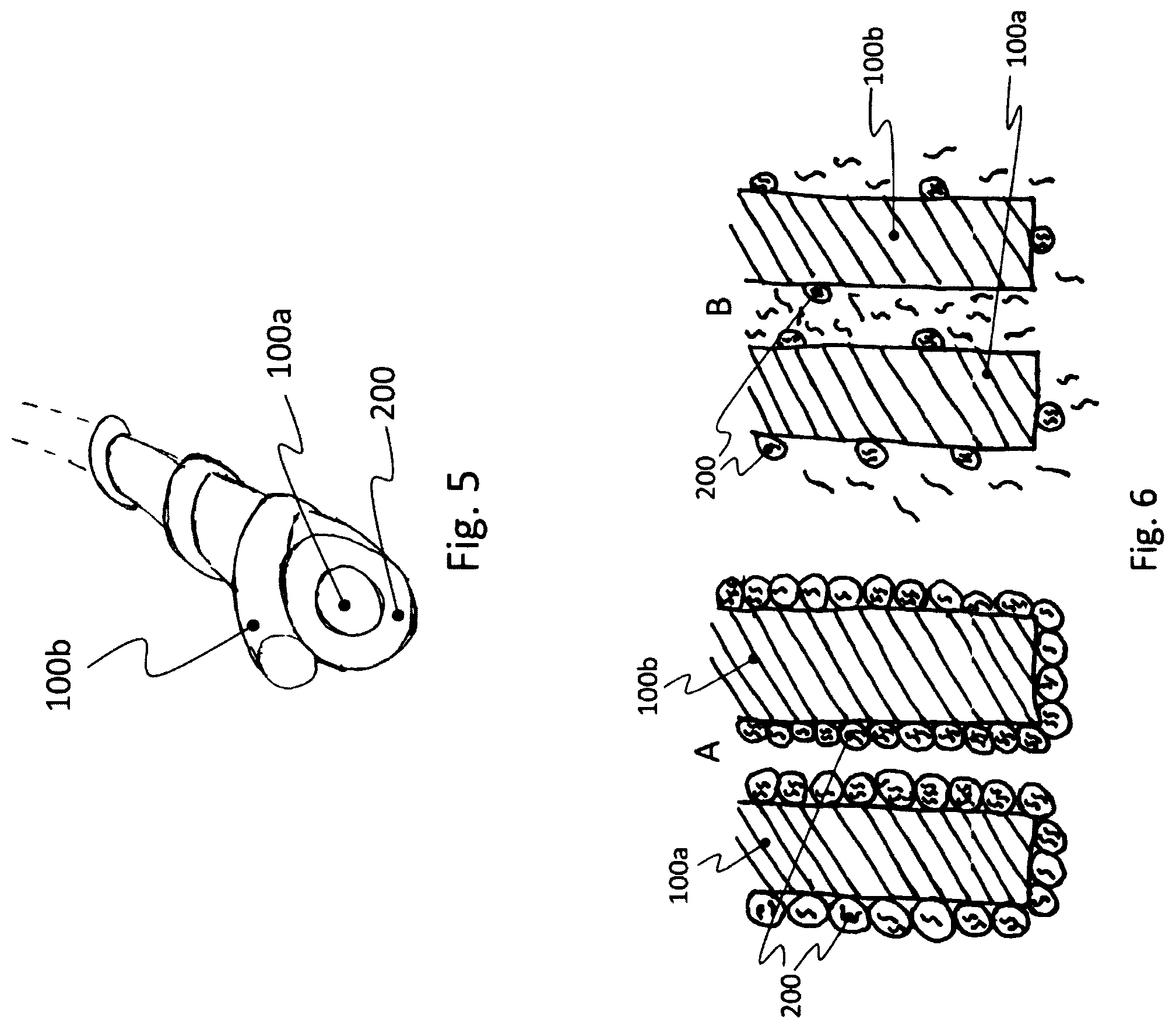 Patent US12551146 Figure 3 – Biosensor and related wound dressing system