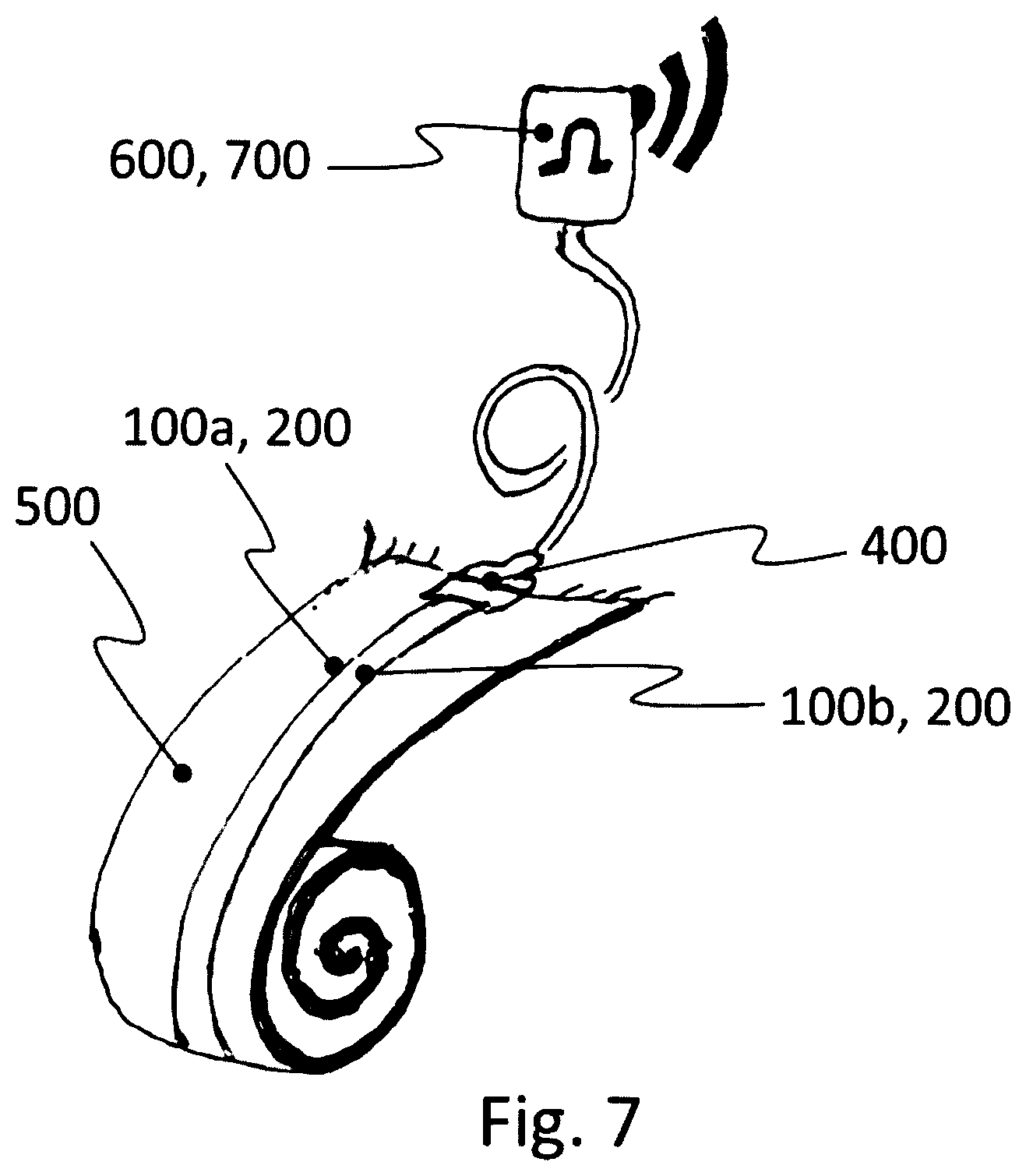 Patent US12551146 Figure 4 – Biosensor and related wound dressing system