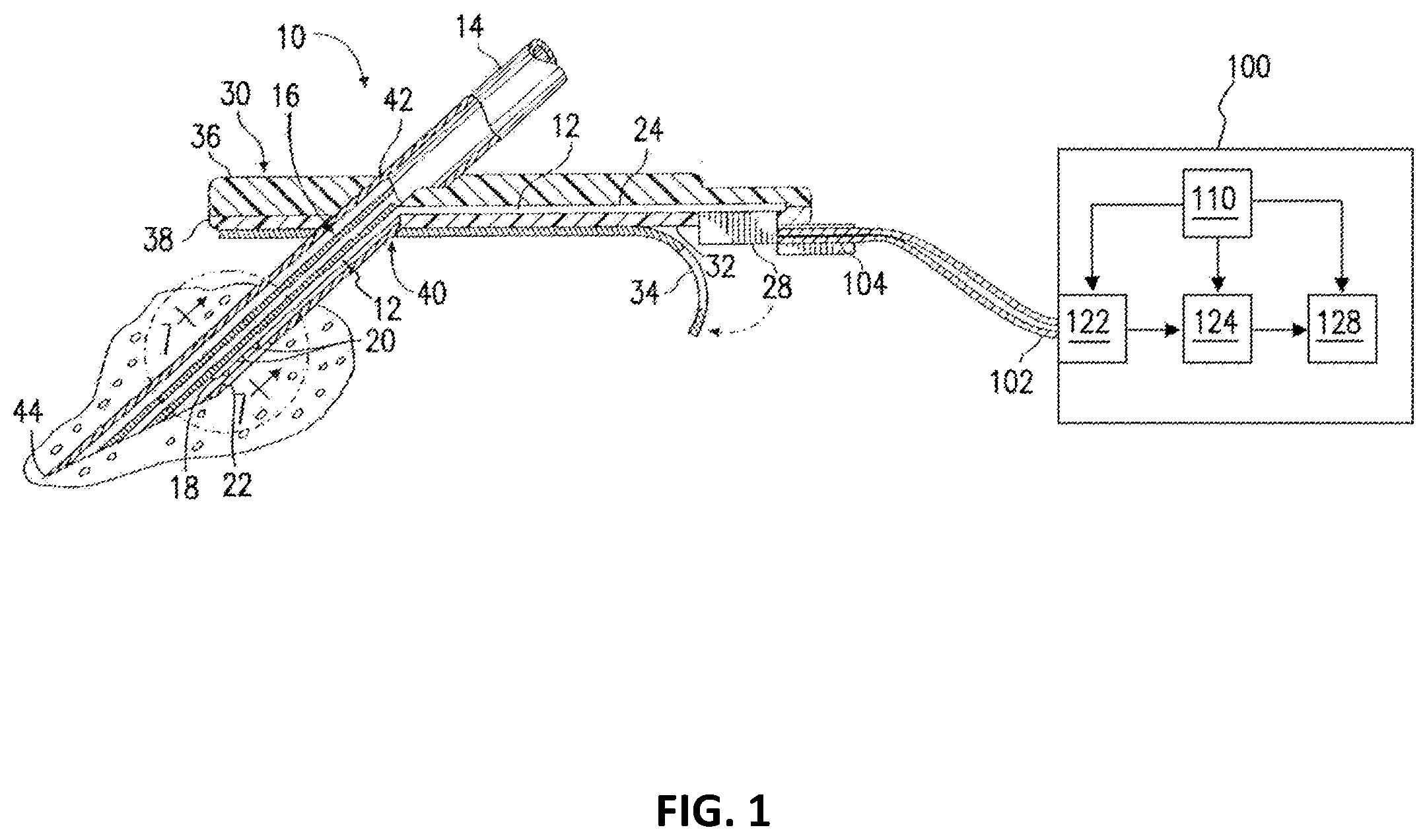 Patent US12551148 Figure 1 – Systems and methods for compensating for agent elution
