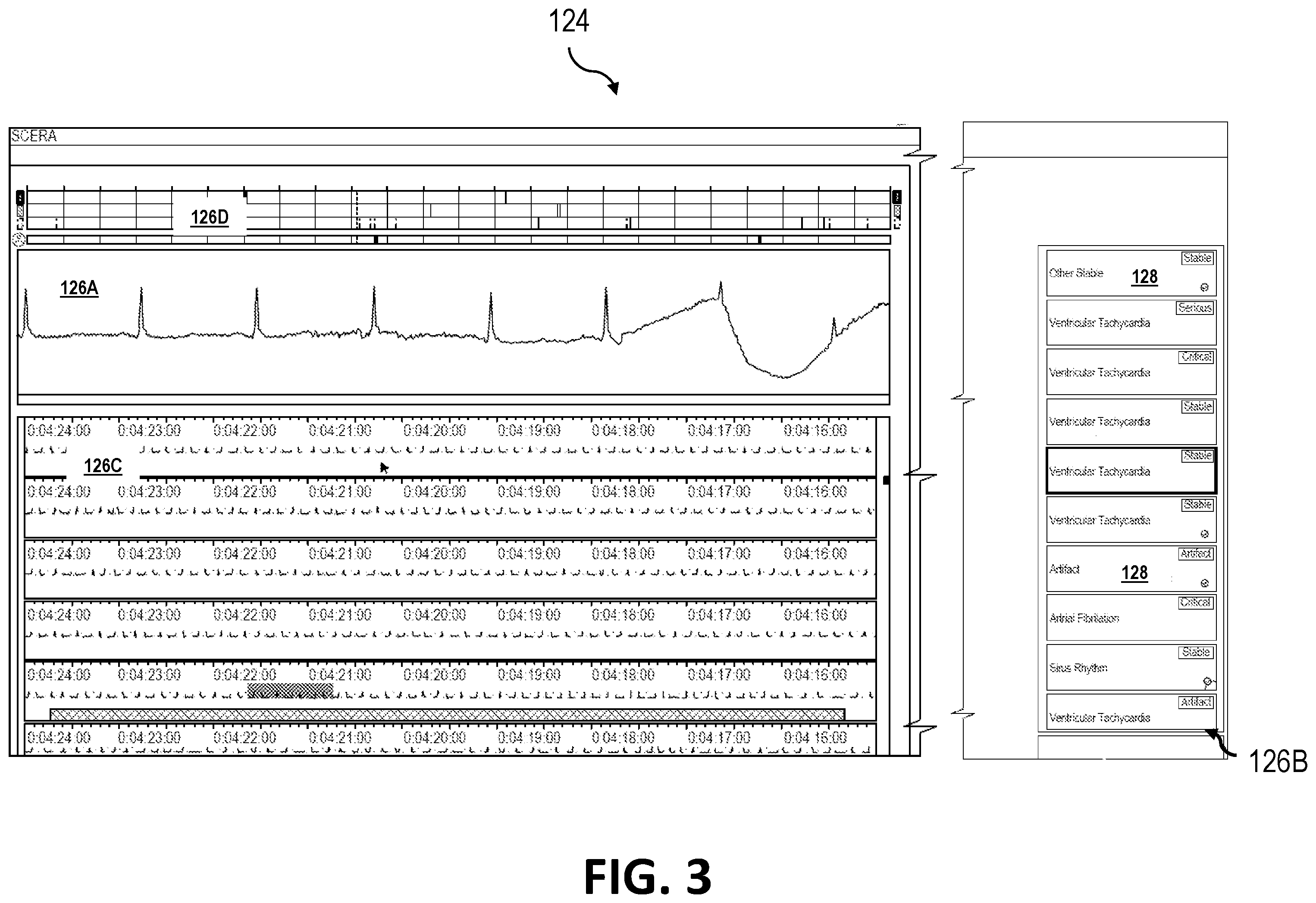 Patent US12551154 Figure 3 – Serious and critical event ECG triage and user interface