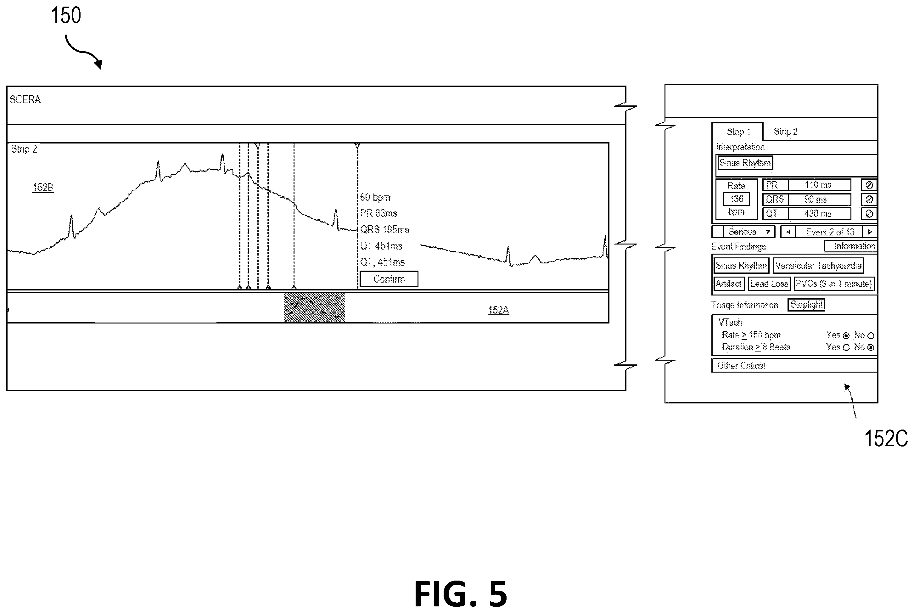 Patent US12551154 Figure 5 – Serious and critical event ECG triage and user interface
