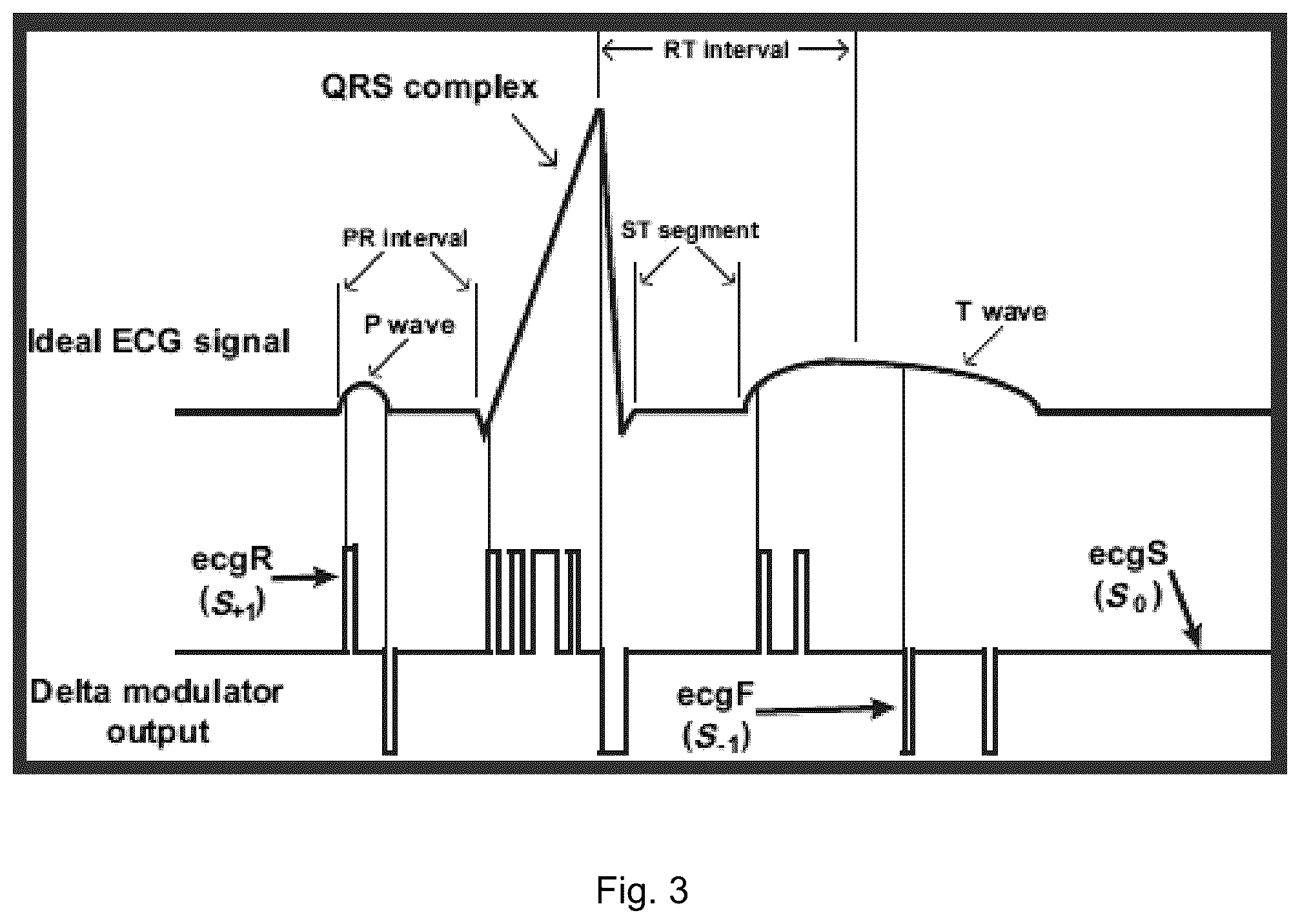Patent US12551155 Figure 4 – Electrocardiogram sensing and processing