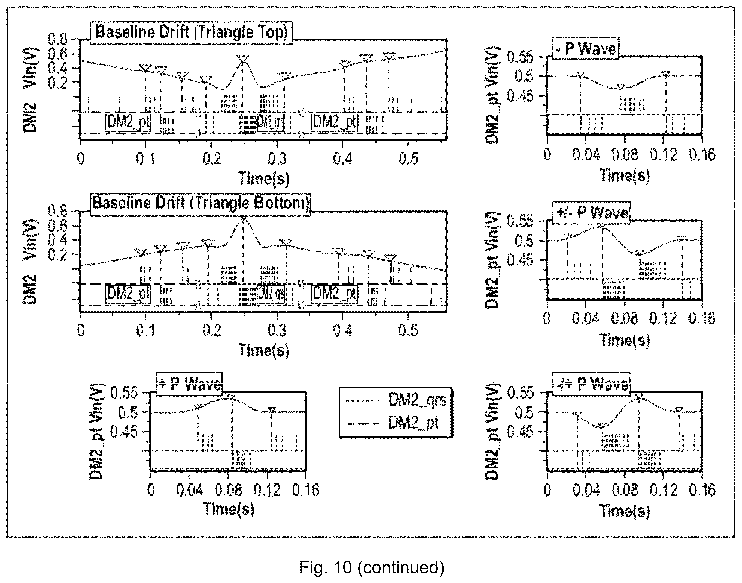 Patent US12551155 Figure 13 – Electrocardiogram sensing and processing
