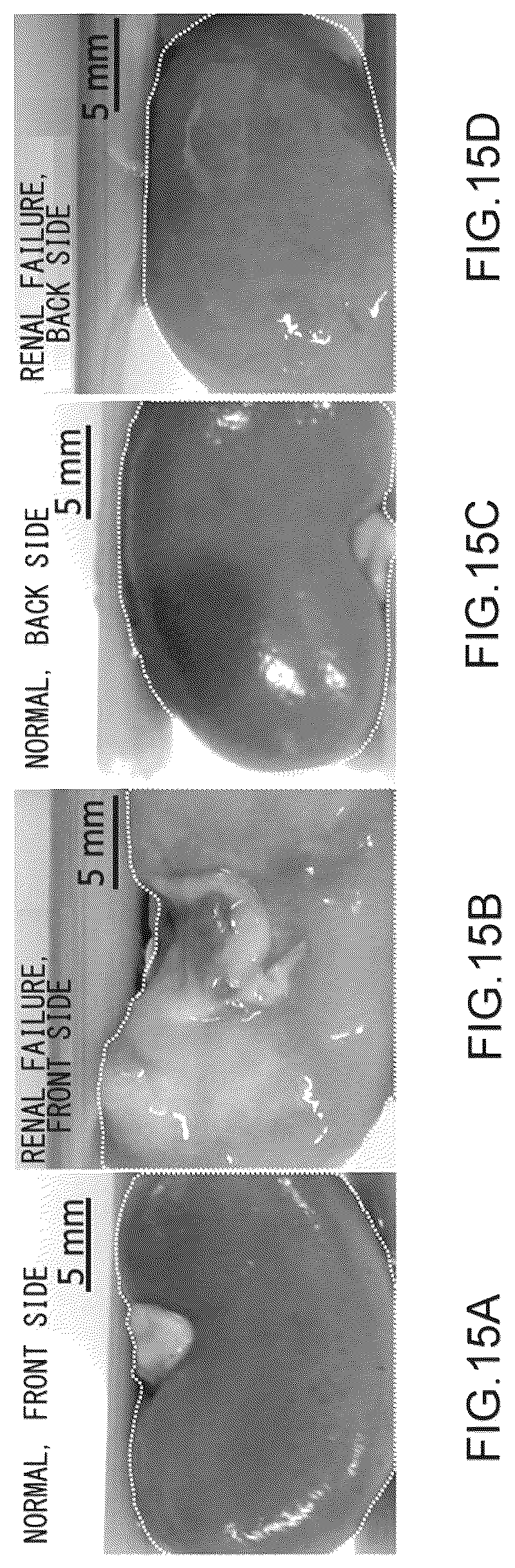Patent US12551156 Figure 15 – Fibrosis measurement device, fibrosis measurement method and property measurement device