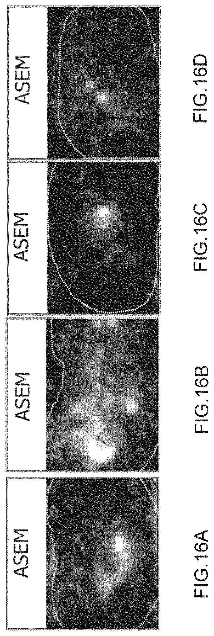 Patent US12551156 Figure 16 – Fibrosis measurement device, fibrosis measurement method and property measurement device