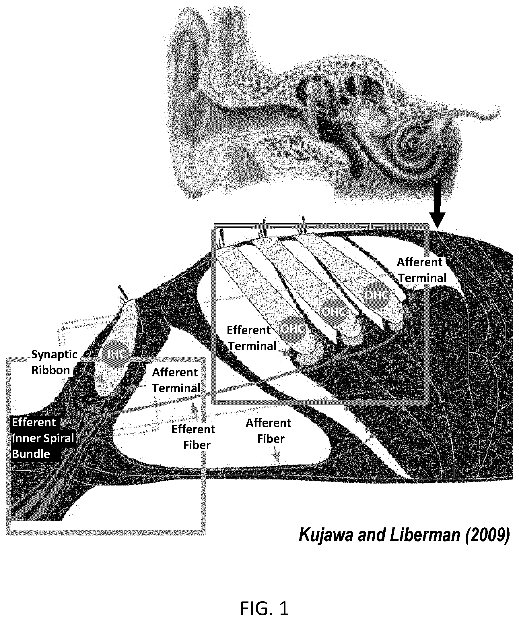 Patent US12551157 Figure 1 – Method and system for determining the integrity of auditory nerve fibers and synapses