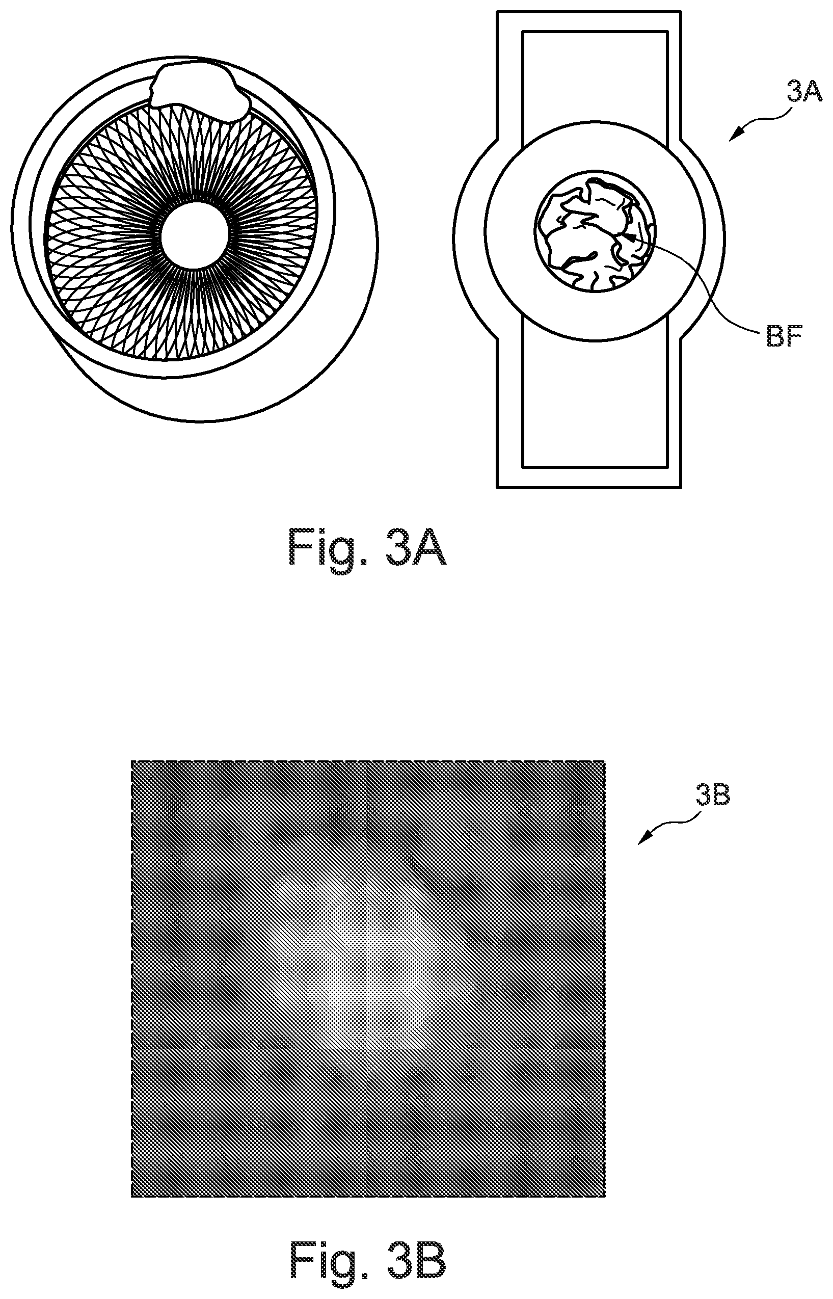 Patent US12551158 Figure 3 – Traumatic brain injury detection