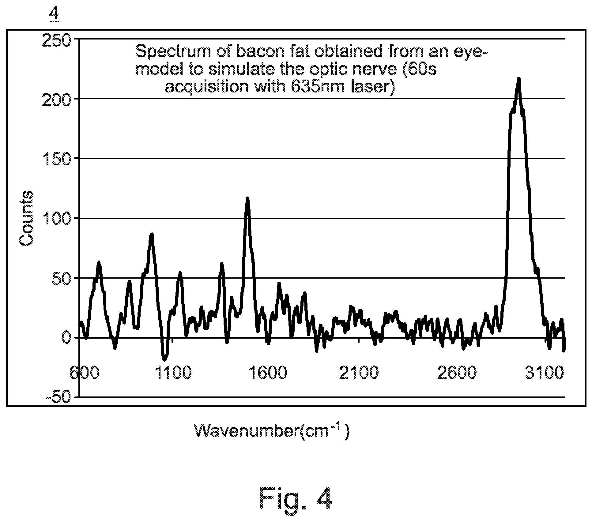 Patent US12551158 Figure 4 – Traumatic brain injury detection