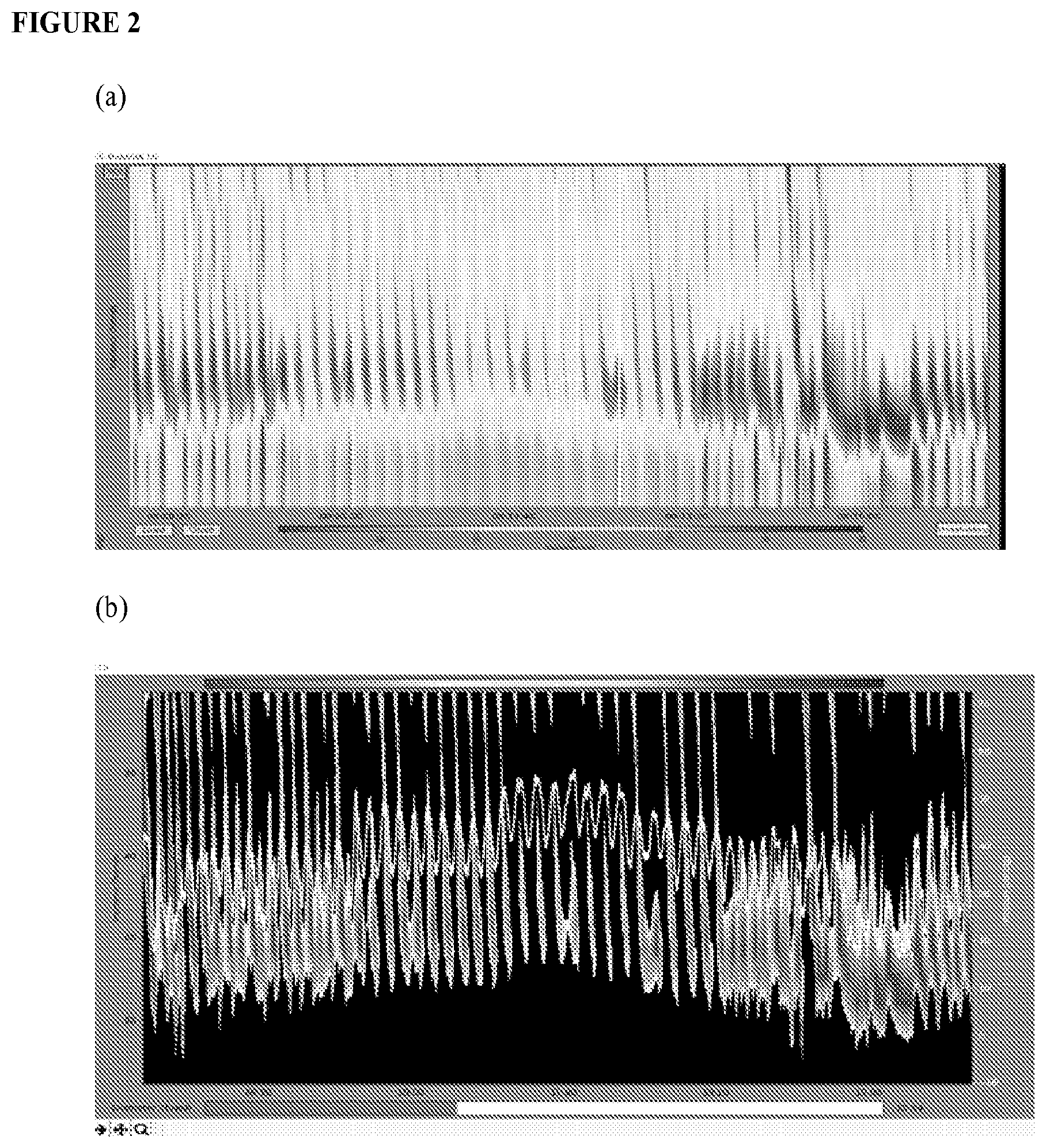 Patent US12551159 Figure 2 – Analysis and display of functional lumen imaging probe (FLIP) data