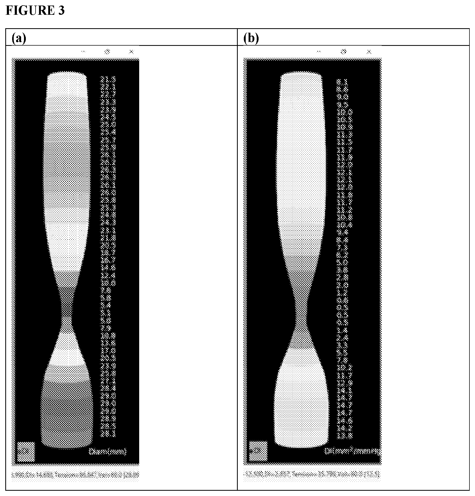 Patent US12551159 Figure 3 – Analysis and display of functional lumen imaging probe (FLIP) data