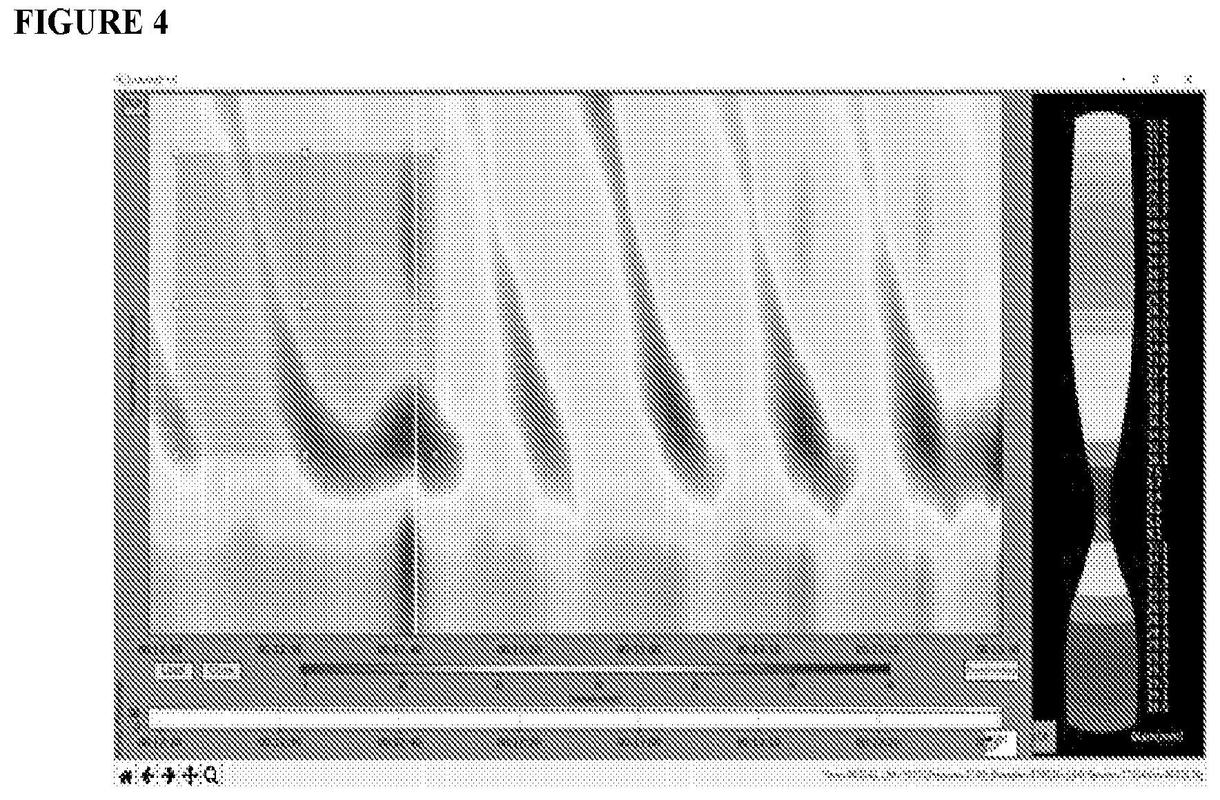 Patent US12551159 Figure 4 – Analysis and display of functional lumen imaging probe (FLIP) data