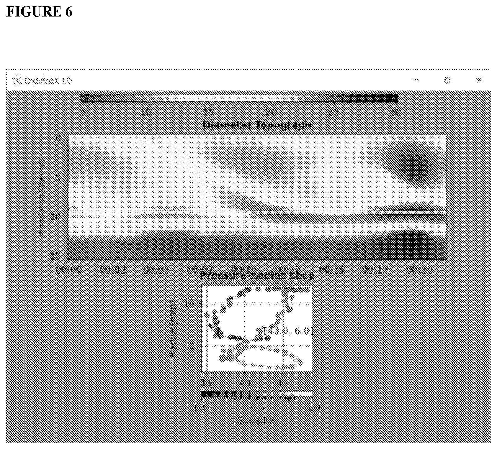 Patent US12551159 Figure 6 – Analysis and display of functional lumen imaging probe (FLIP) data