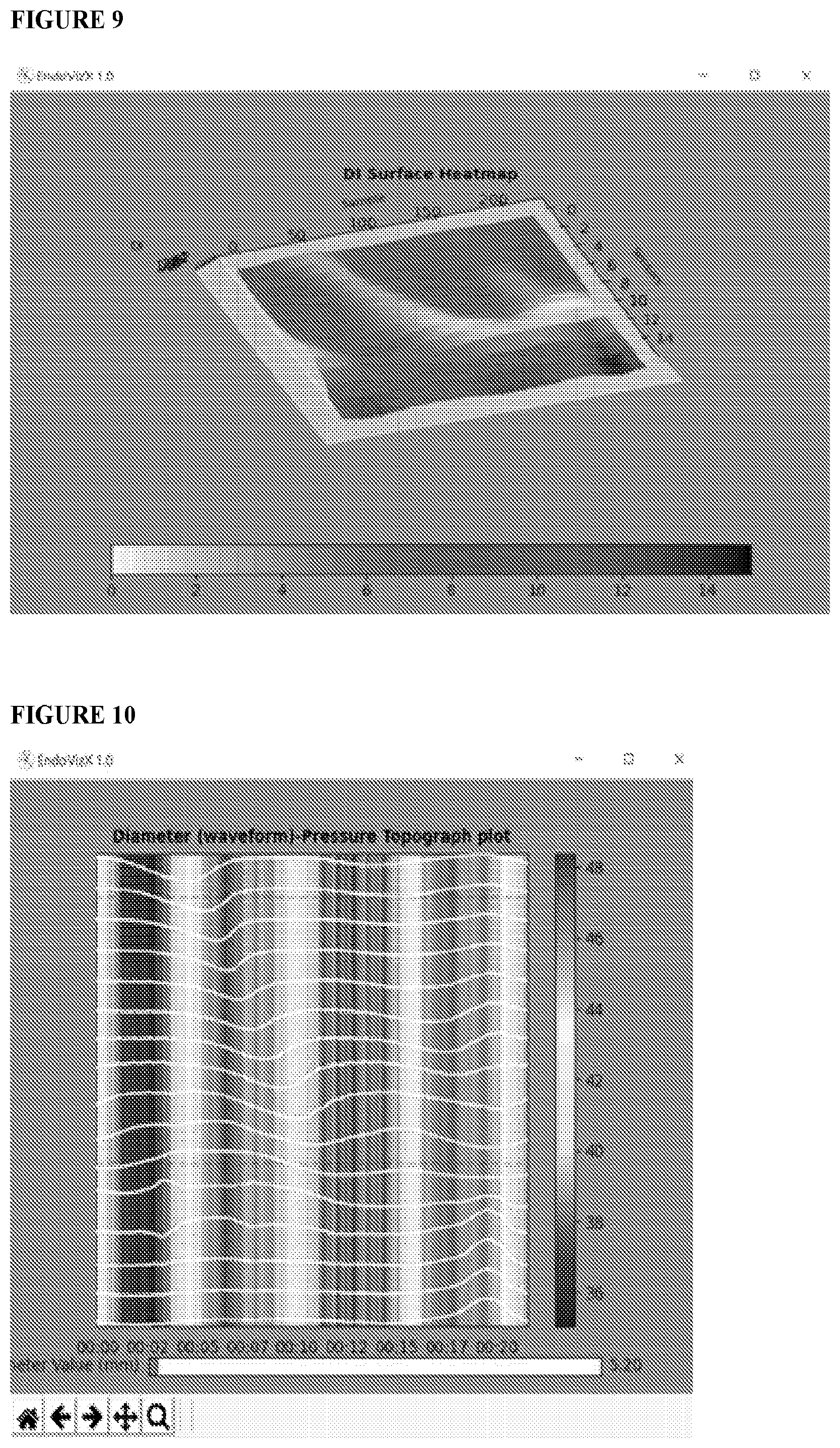 Patent US12551159 Figure 8 – Analysis and display of functional lumen imaging probe (FLIP) data