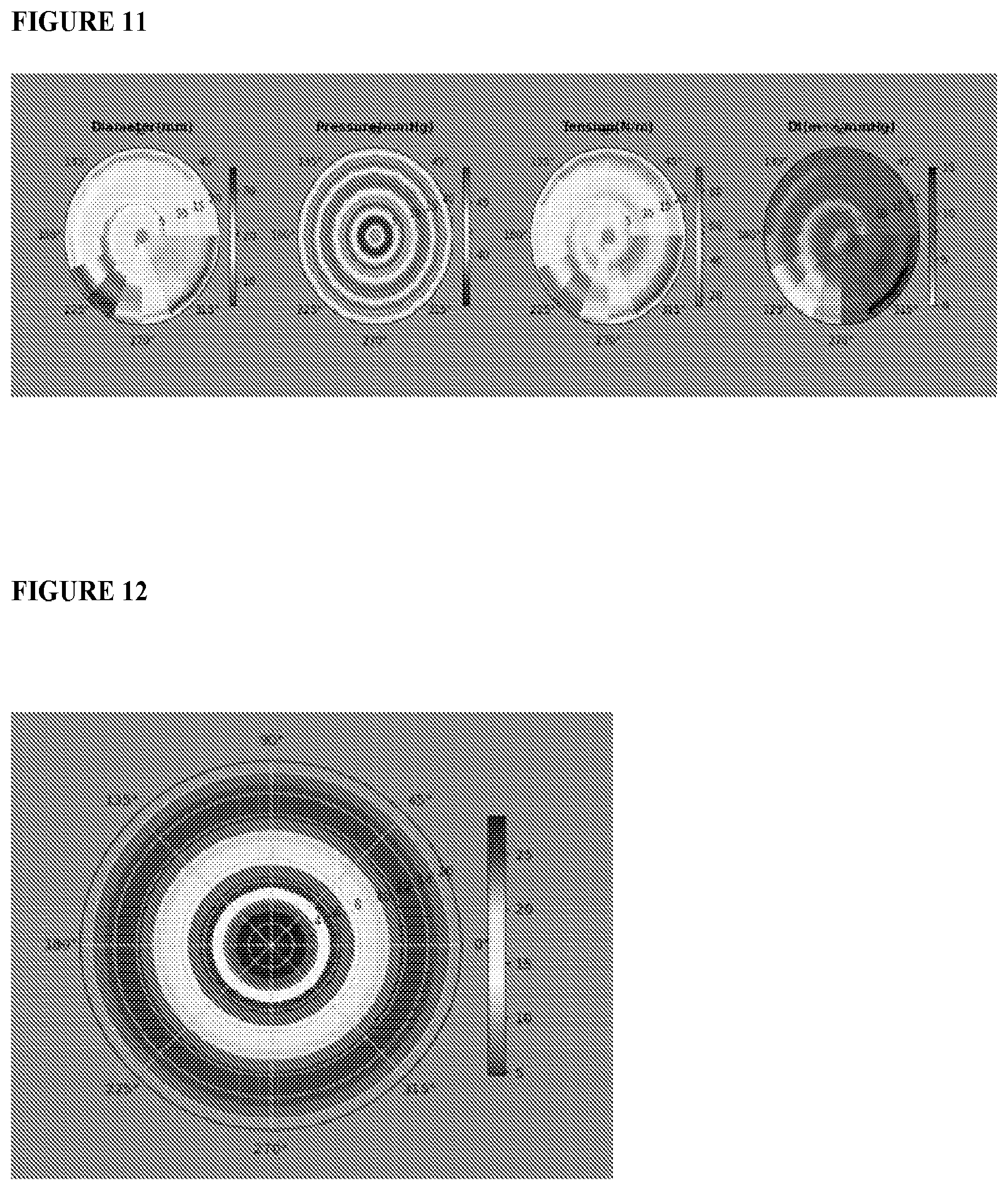 Patent US12551159 Figure 9 – Analysis and display of functional lumen imaging probe (FLIP) data