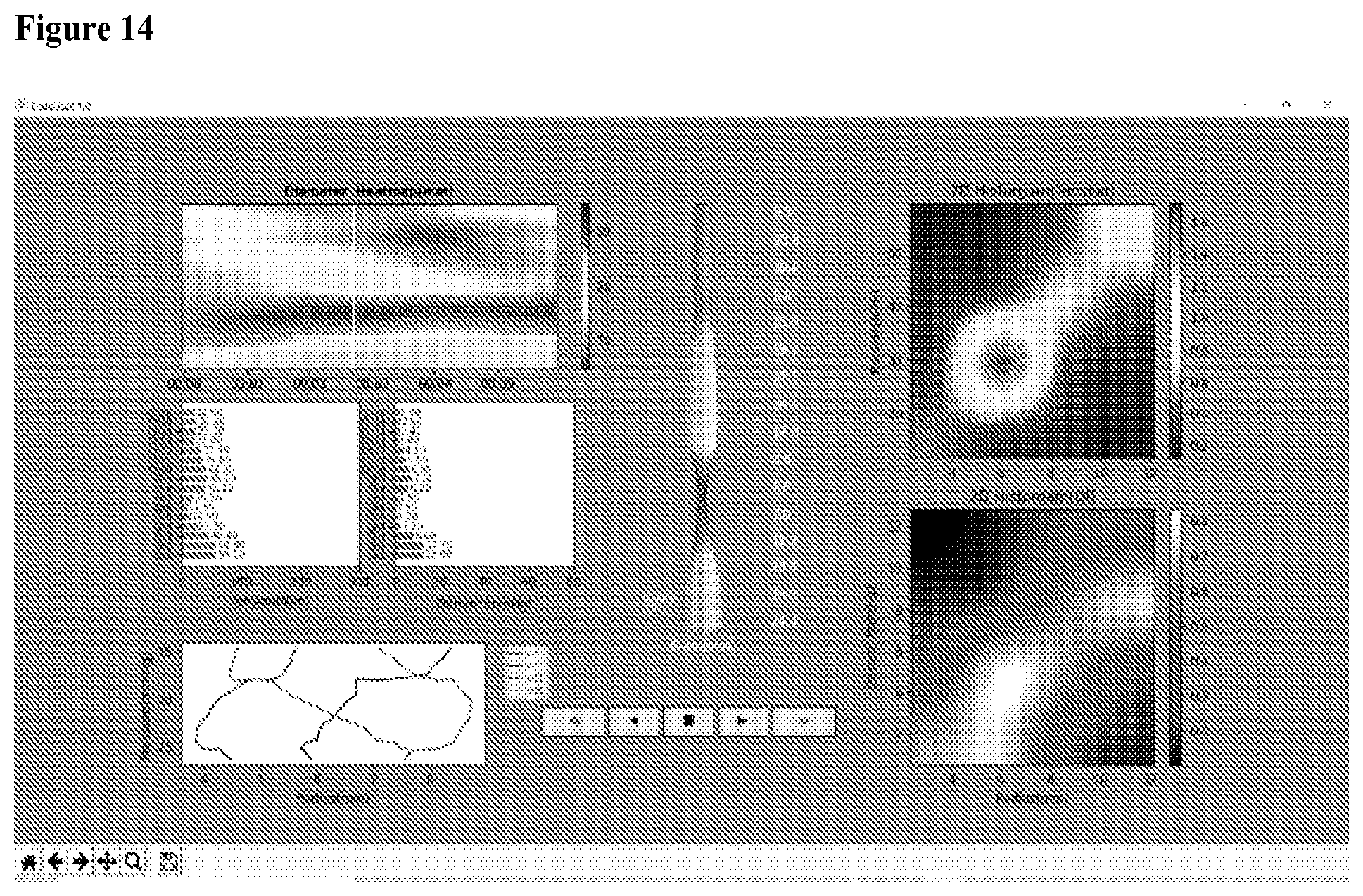 Patent US12551159 Figure 11 – Analysis and display of functional lumen imaging probe (FLIP) data