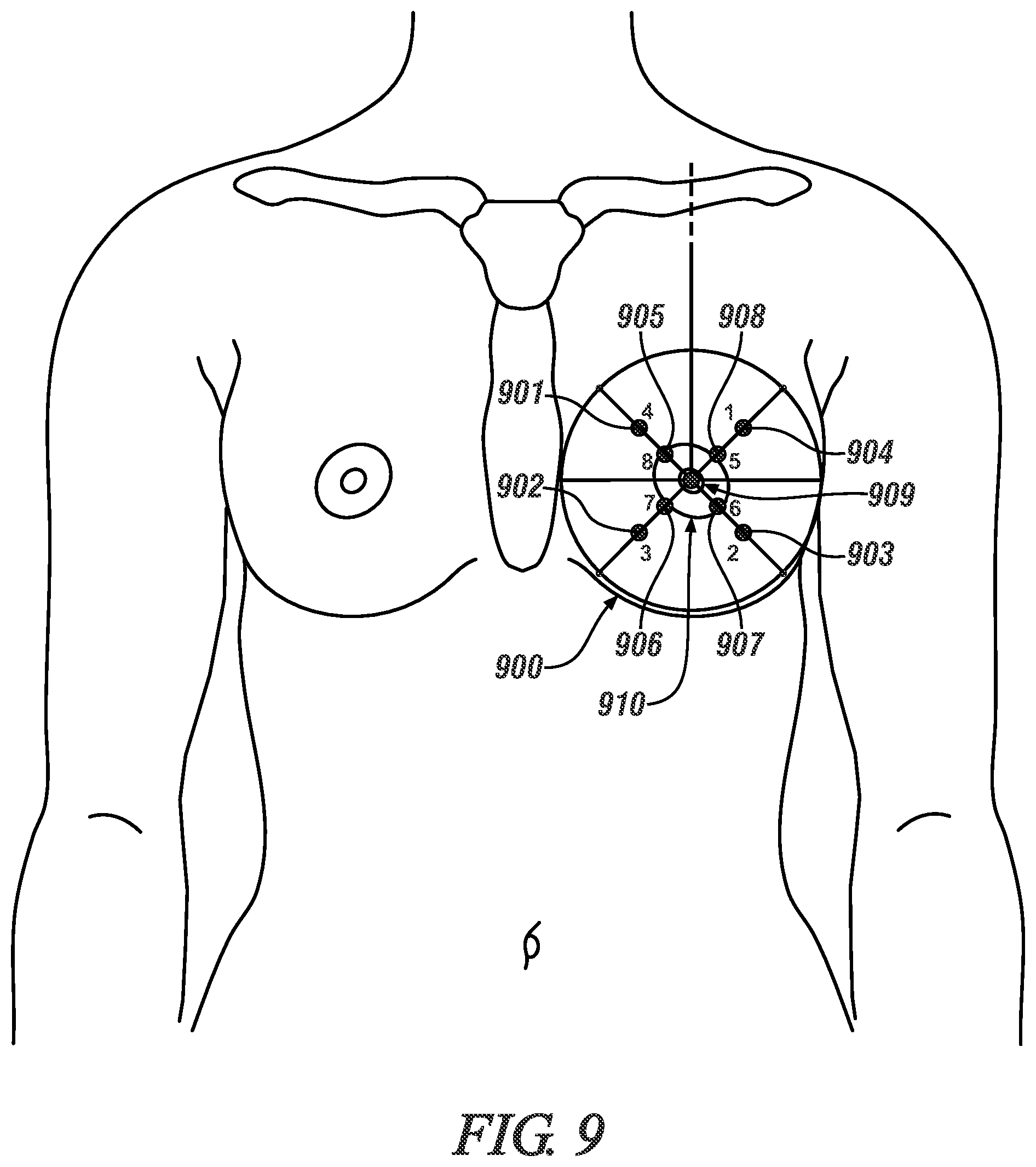 Patent US12551160 Figure 6 – System and method for measuring human milk production