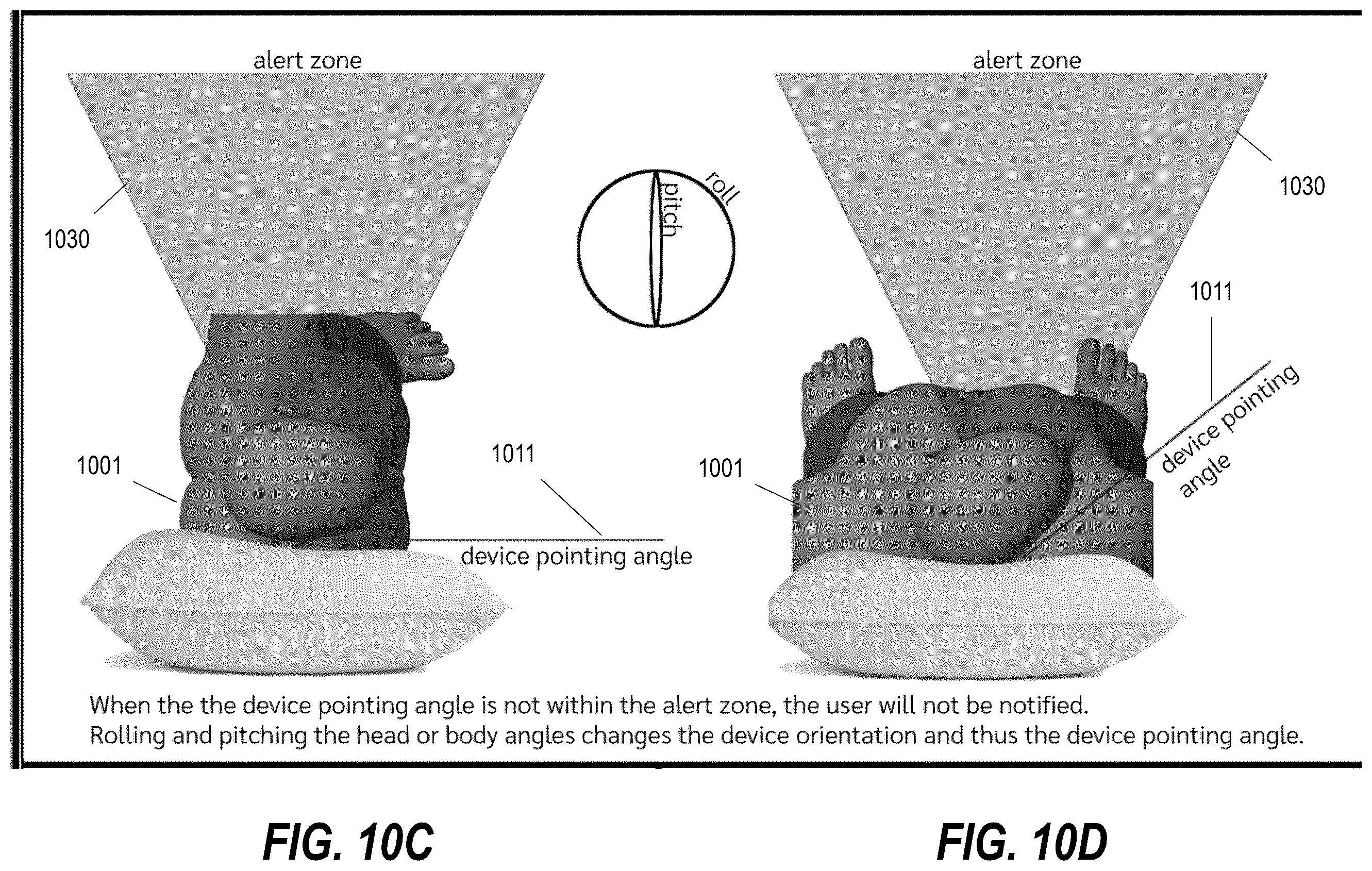 Patent US12551164 Figure 11 – Diagnostic tool and therapeutic methods for sleep respiratory issues via a positional therapy ear device using audible notification