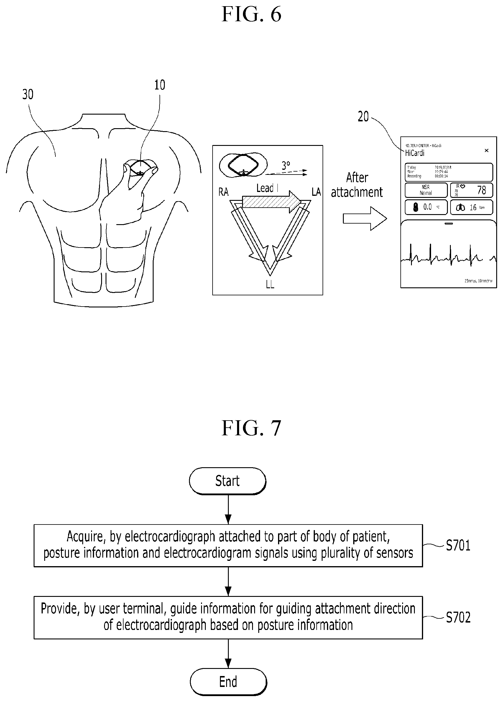 Patent US12551165 Figure 4 – Electrocardiogram lead guide system and method