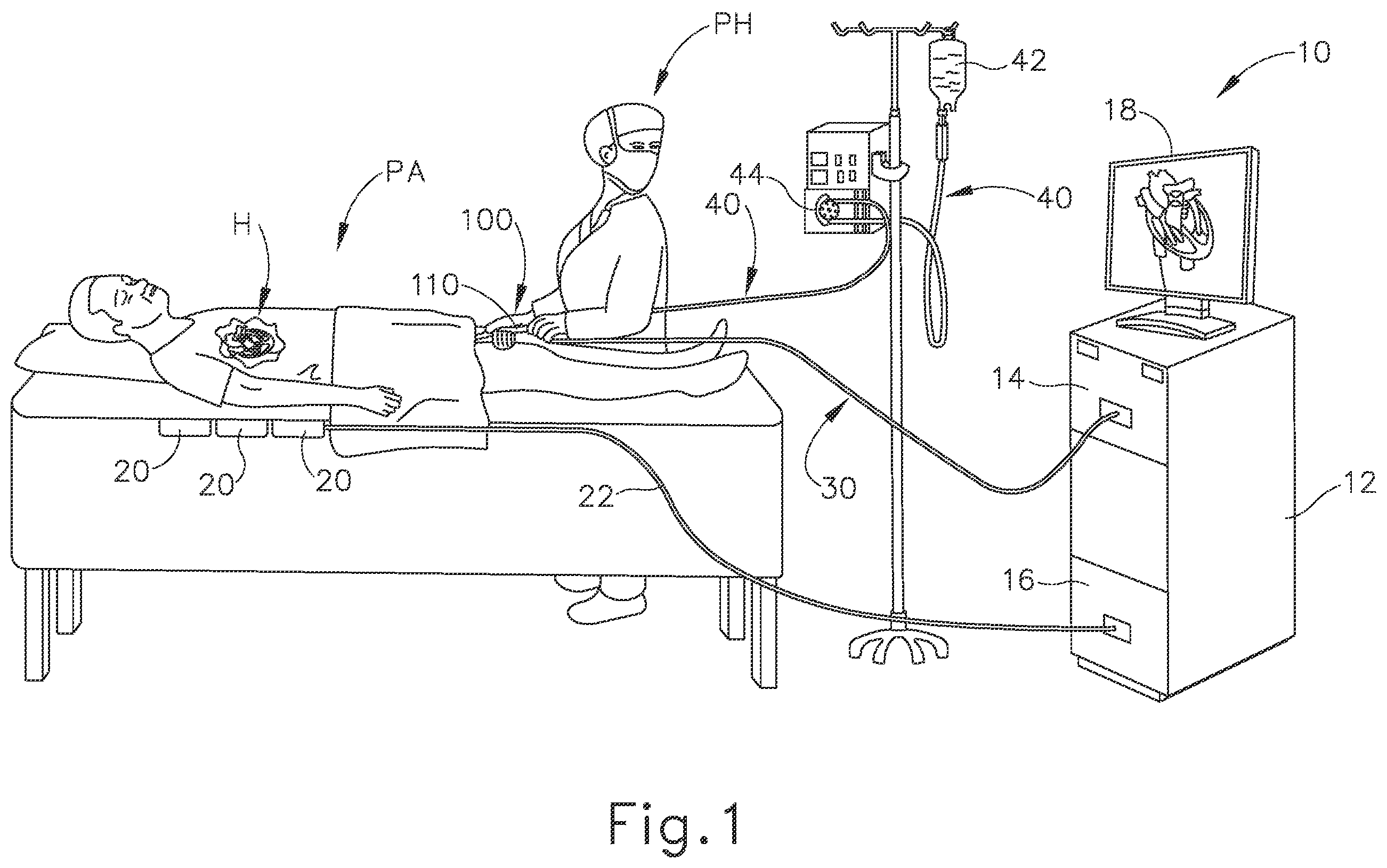 Patent US12551166 Figure 1 – Reference wires to remove noise and artifacts in cardiac mapping catheter