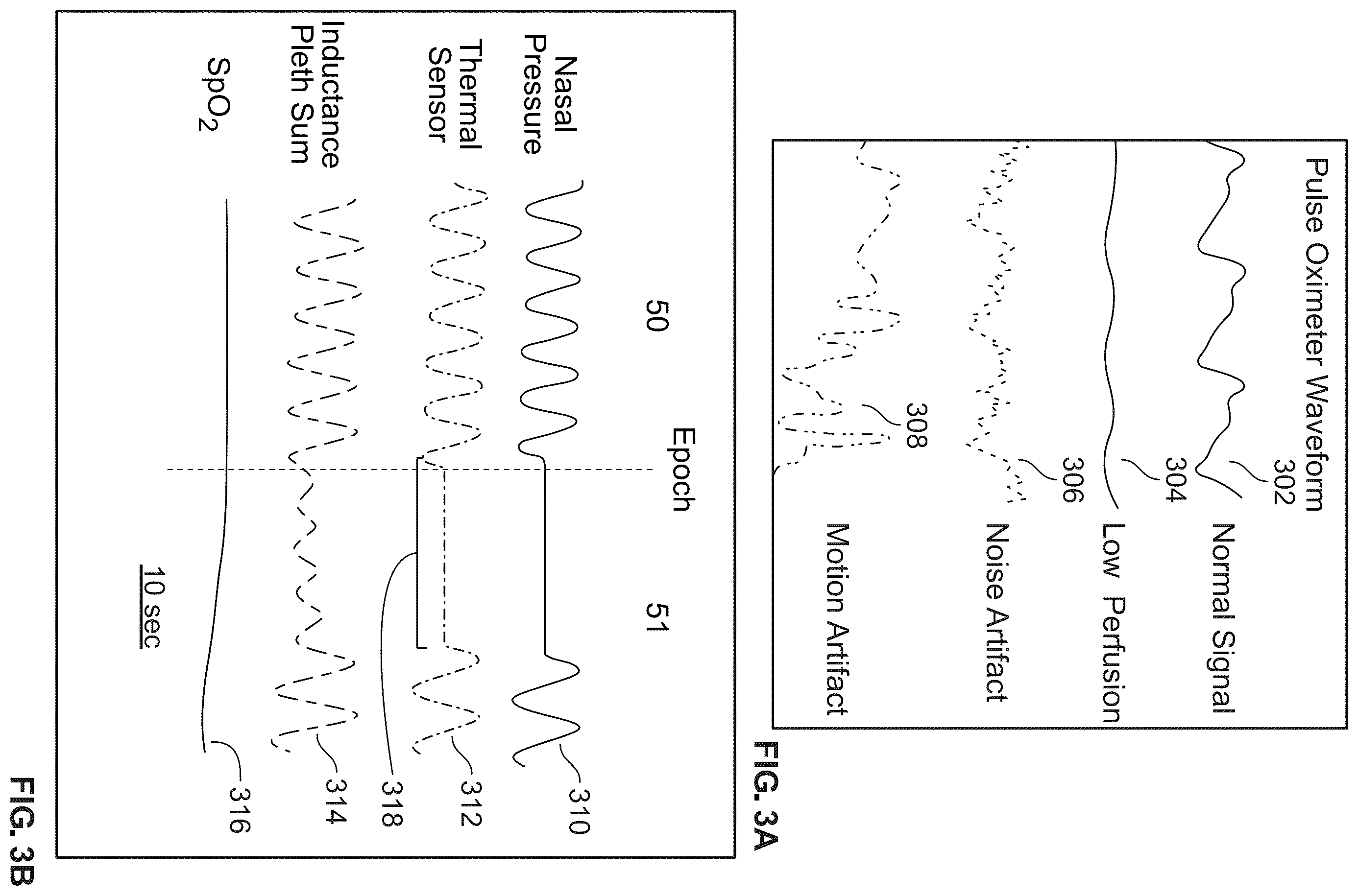 Patent US12551168 Figure 3 – Enhanced pulse oximetry systems and methods for the diagnoses of sleep-associated breathing disorders