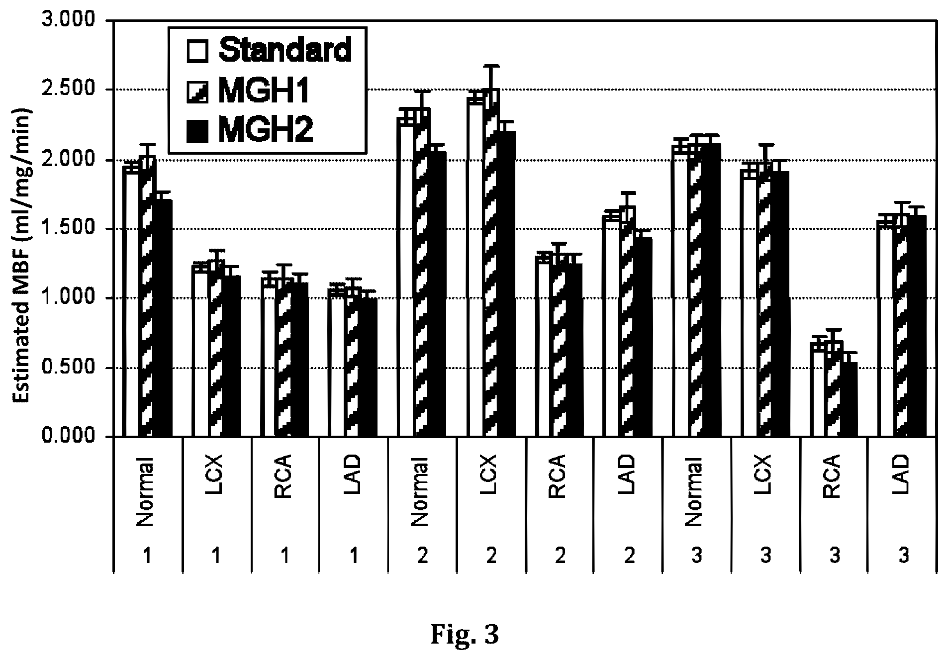 Patent US12551173 Figure 3 – System and method for single-scan rest-stress cardiac PET